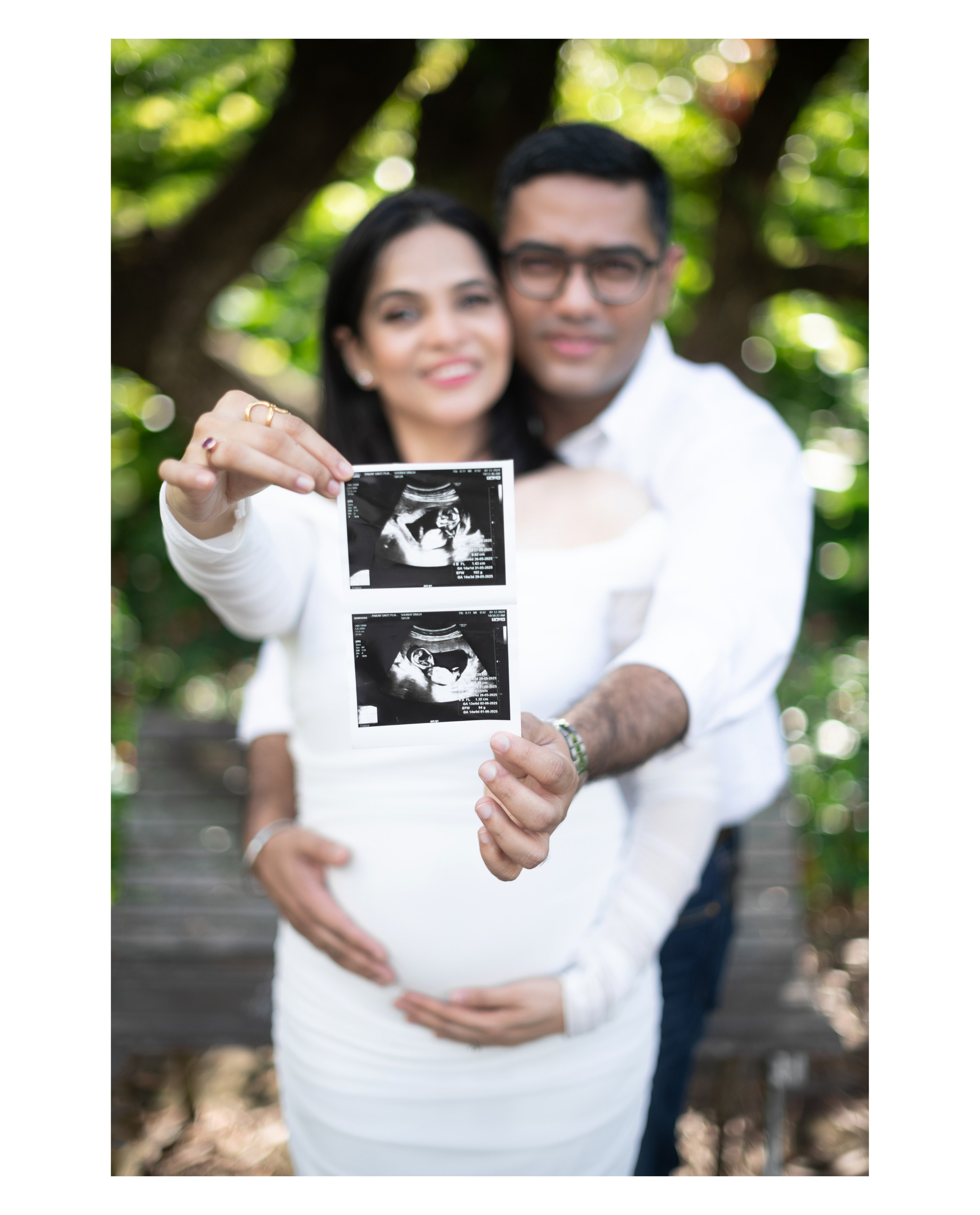 Outdoor maternity portrait in Singapore’s greenery: smiling parents-to-be hold two ultrasound images toward the lens while mum’s white dress and dad’s embrace frame the baby bump.