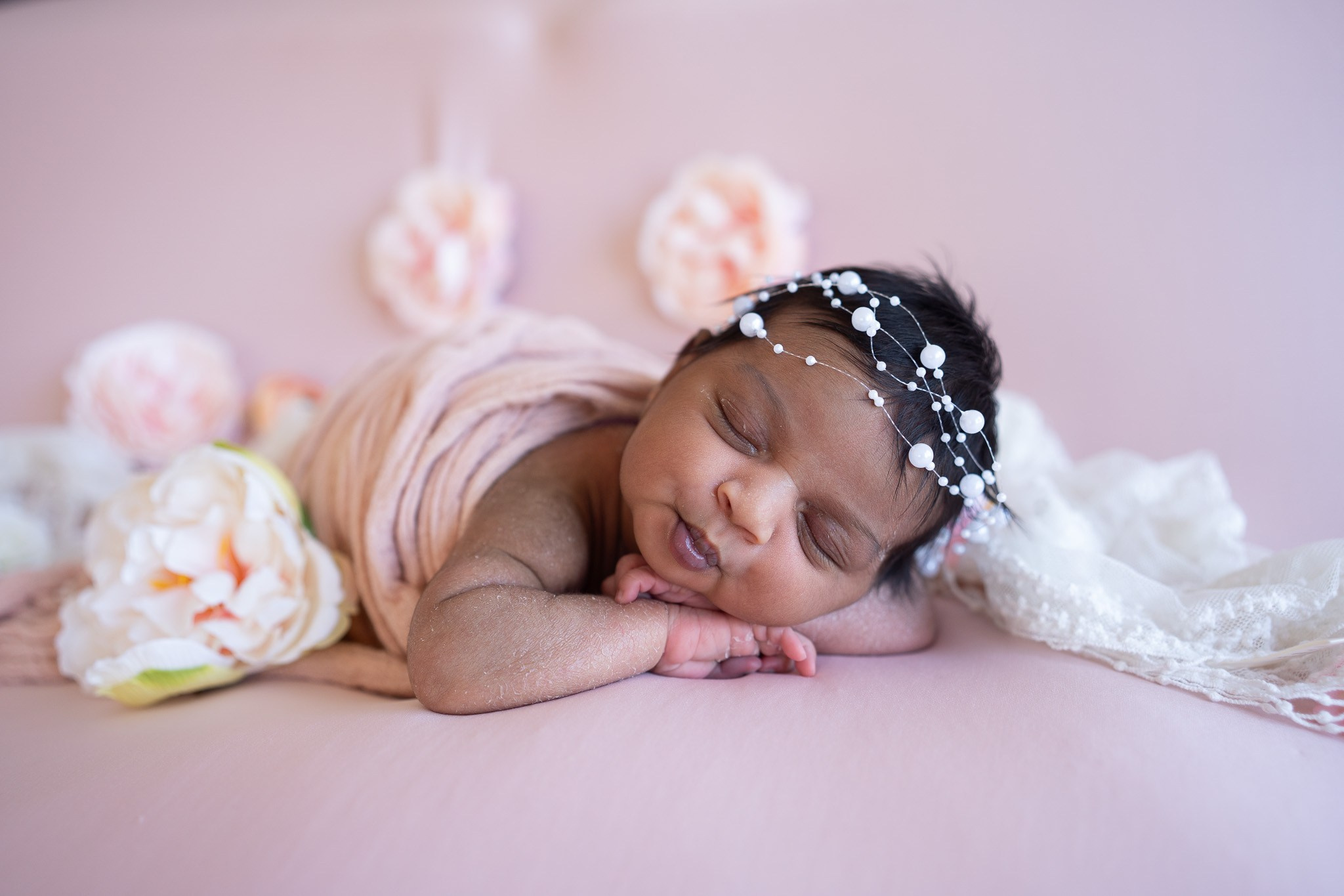 Should You Postpone Your Newborn Photo Session If Your Baby Has Acne? (Answered by a Pro Photographer). Maternity, family and newborn photography in San Francisco Bay Area