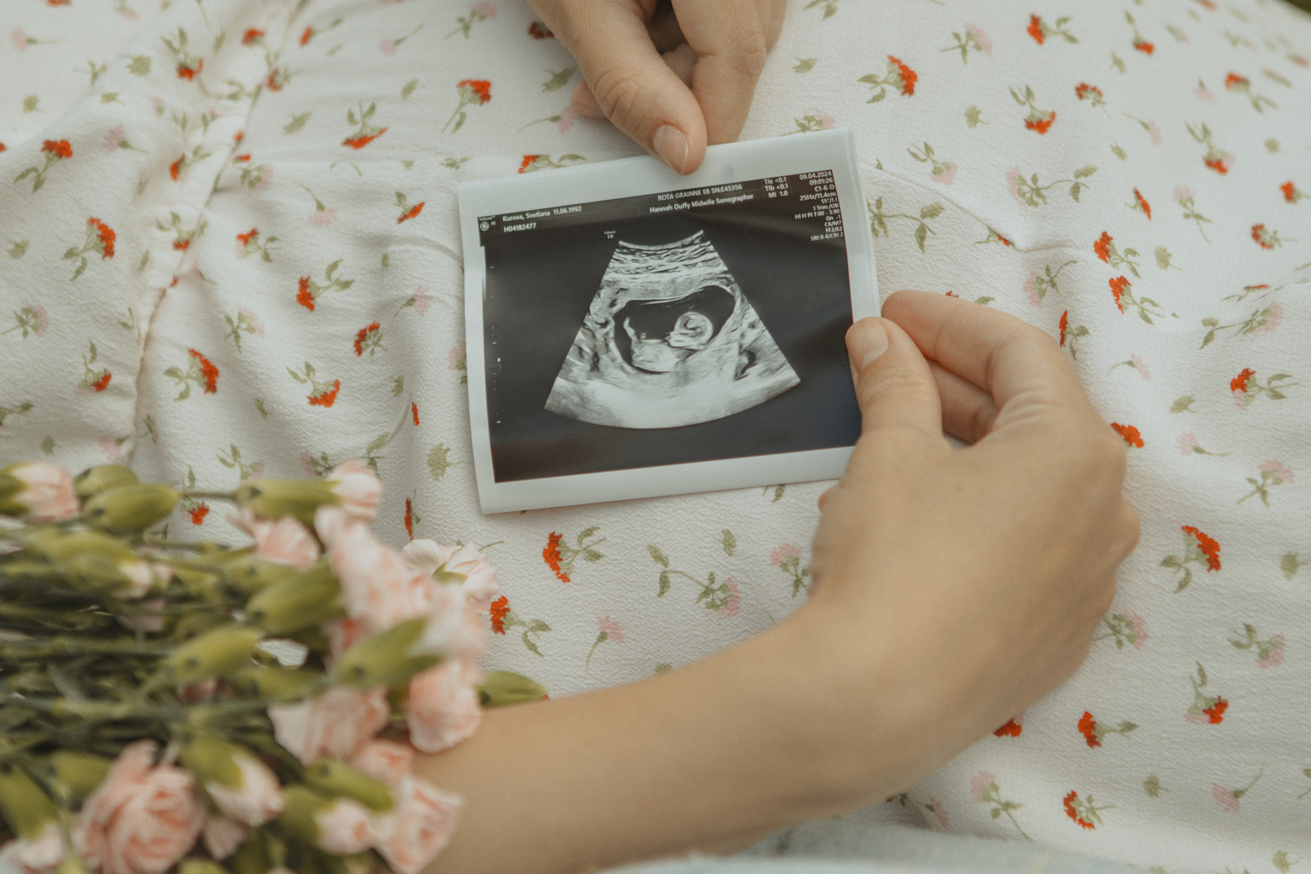 Expecting Pregnancy. Photographer Margarita Antonova in Naas, Co Kildare