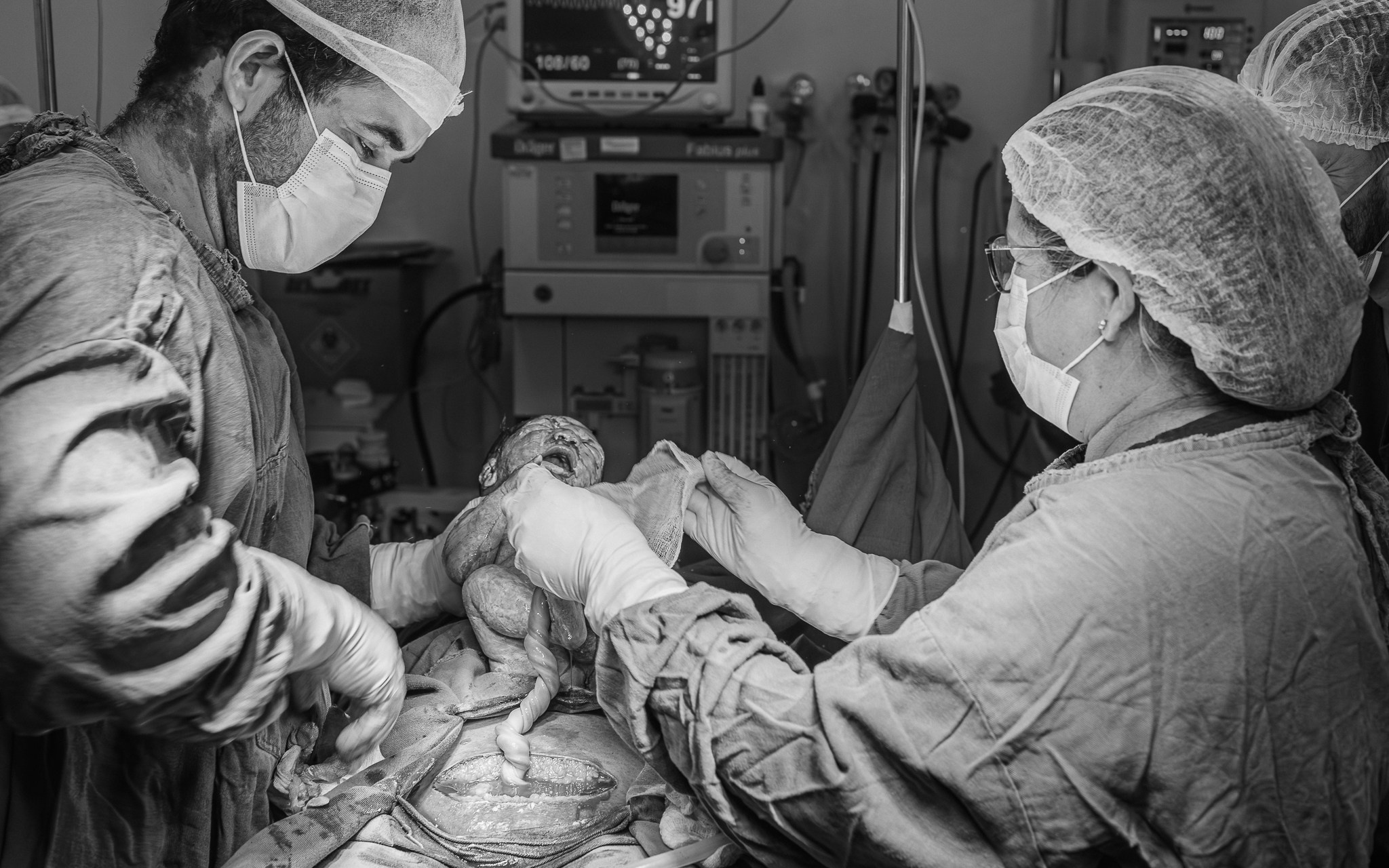 fotografo-de-parto-registro-momento-unico-nascimento-vaginal amor-incondicional-mae-e-filho-contato-pele-a-pele-pos-parto