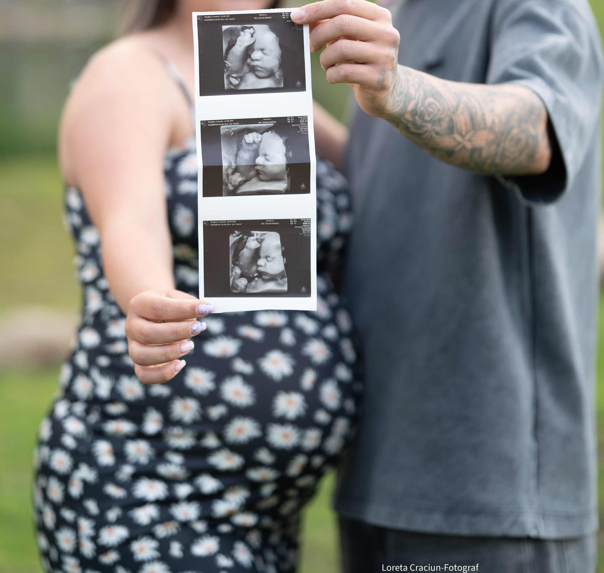Maternity. Fotograf Loreta Craciun