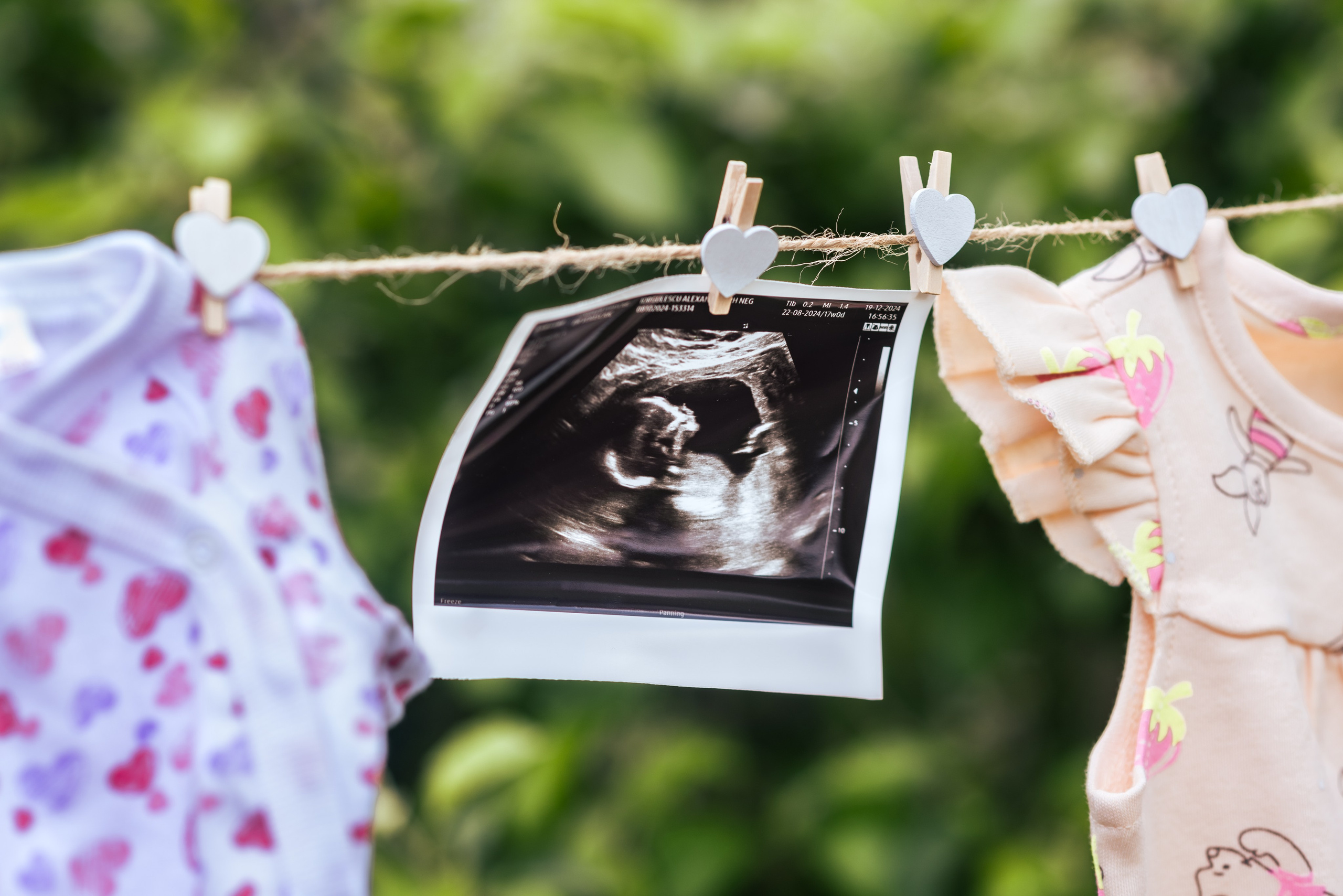 Maternitate. Fotografie și videografie de nuntă în Romania