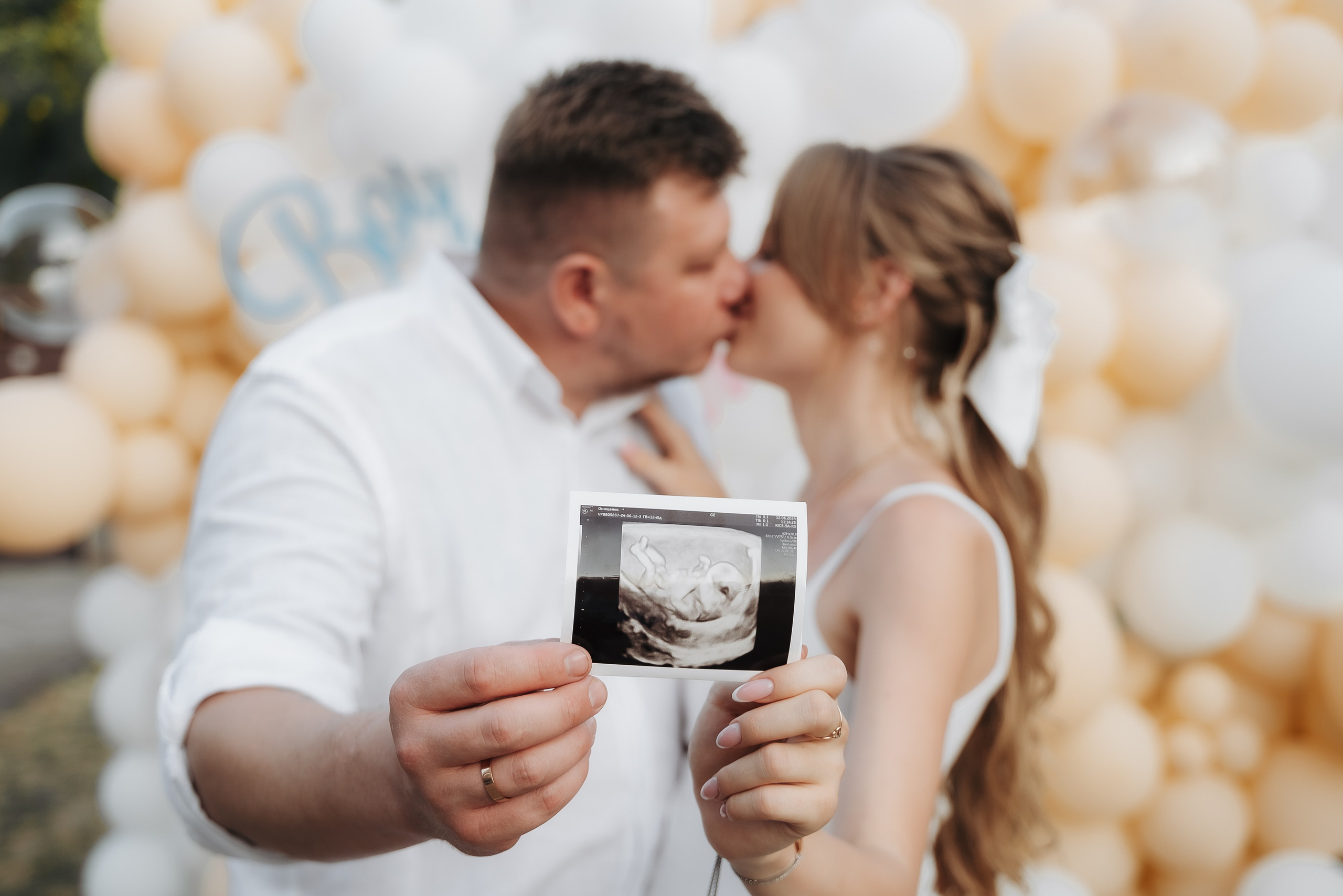 Gender Party. ST.PHOTO13