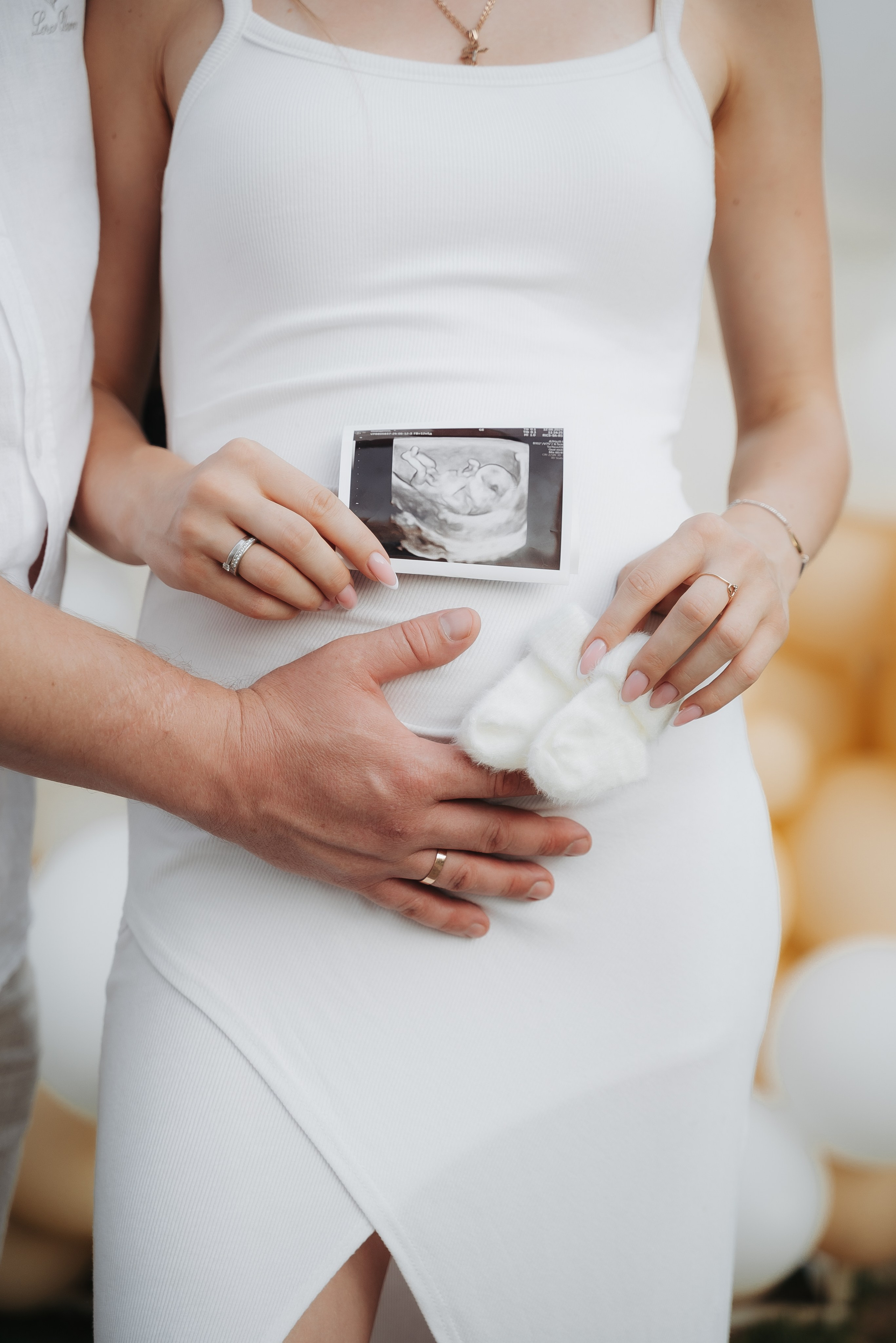 Gender Party. ST.PHOTO13