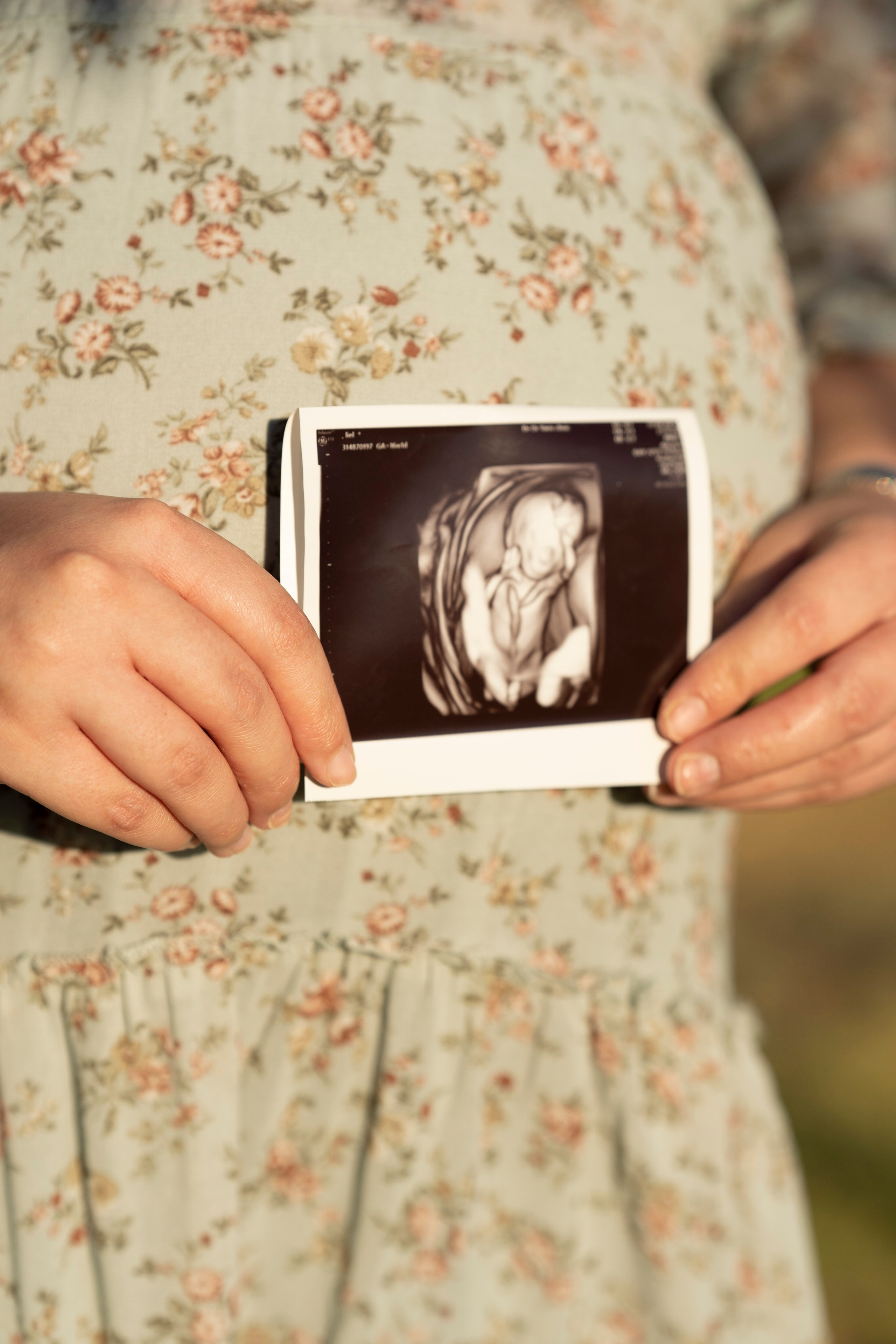 ליאל ודוד. יוסף מזרחי צילום חתונה, ברית וזוגיות. צלם מקצועי שאוהב להוציא אתכם הכי יפים ברגעים הכי מרגשים