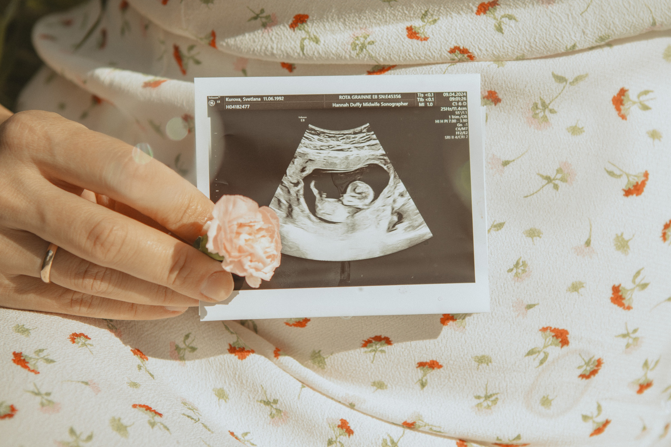 Expecting Pregnancy. Photographer Margarita Antonova in Naas, Co Kildare