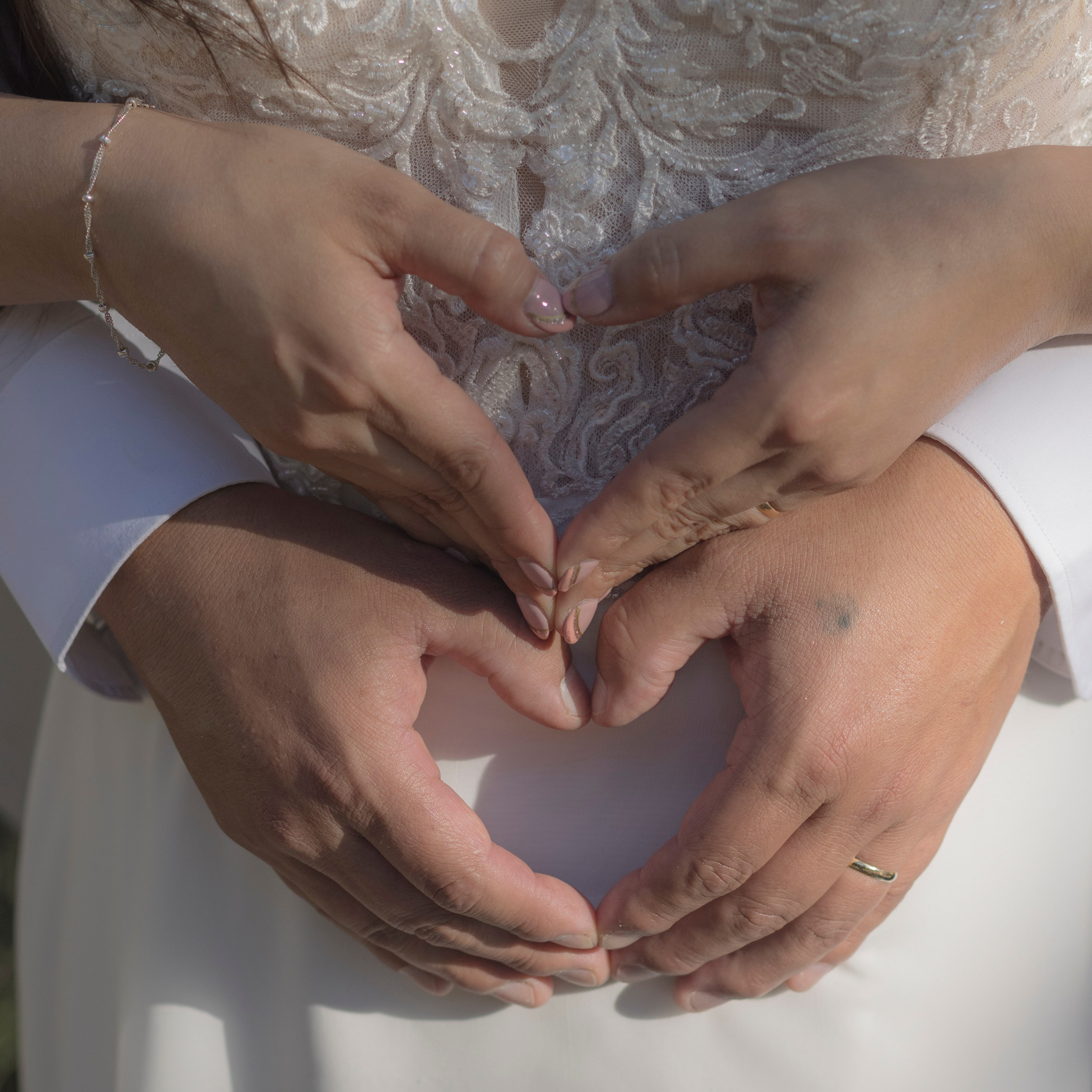 Susan y José Luis. Dinka & Emilio - El arte de preservar lo que no se repite