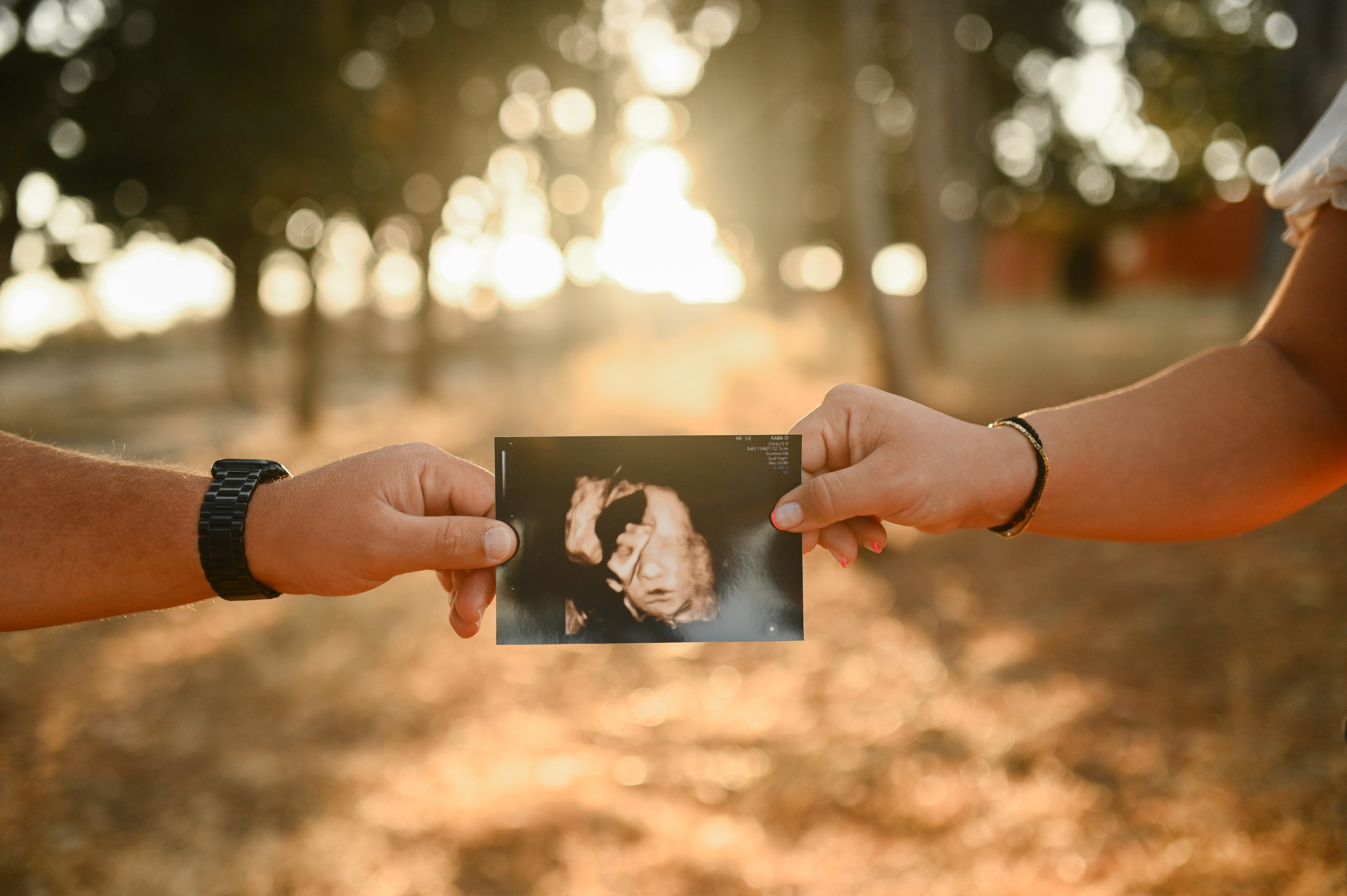 Φωτογράφιση εγκυμοσύνης στο Φιλέρημο Ρόδου – Μαγικές στιγμές μέσα στη φύση. WELCOME