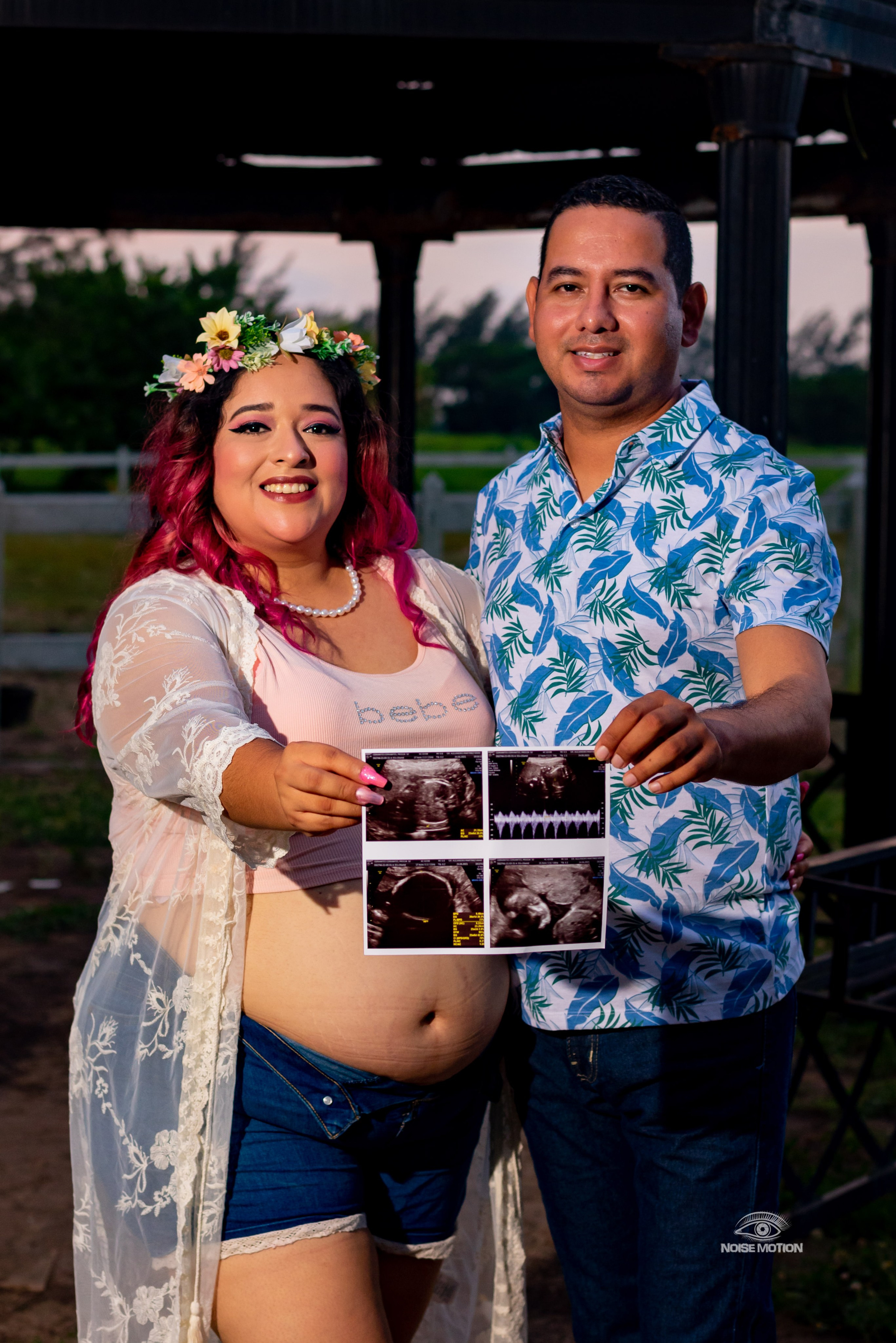 Maternidad. Fotografía Profesional - Noise Motion