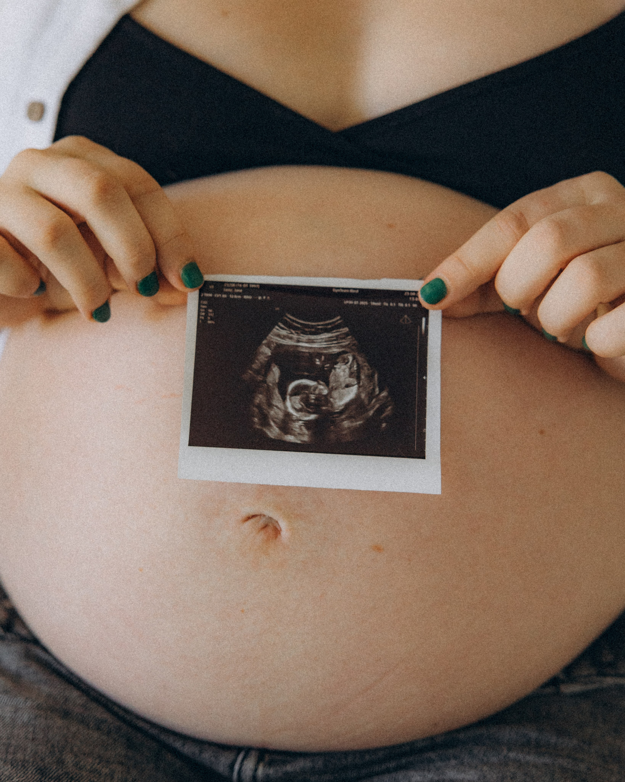 Janas Pregnancy. Hochzeits- und Porträtfotografin in Deutschland