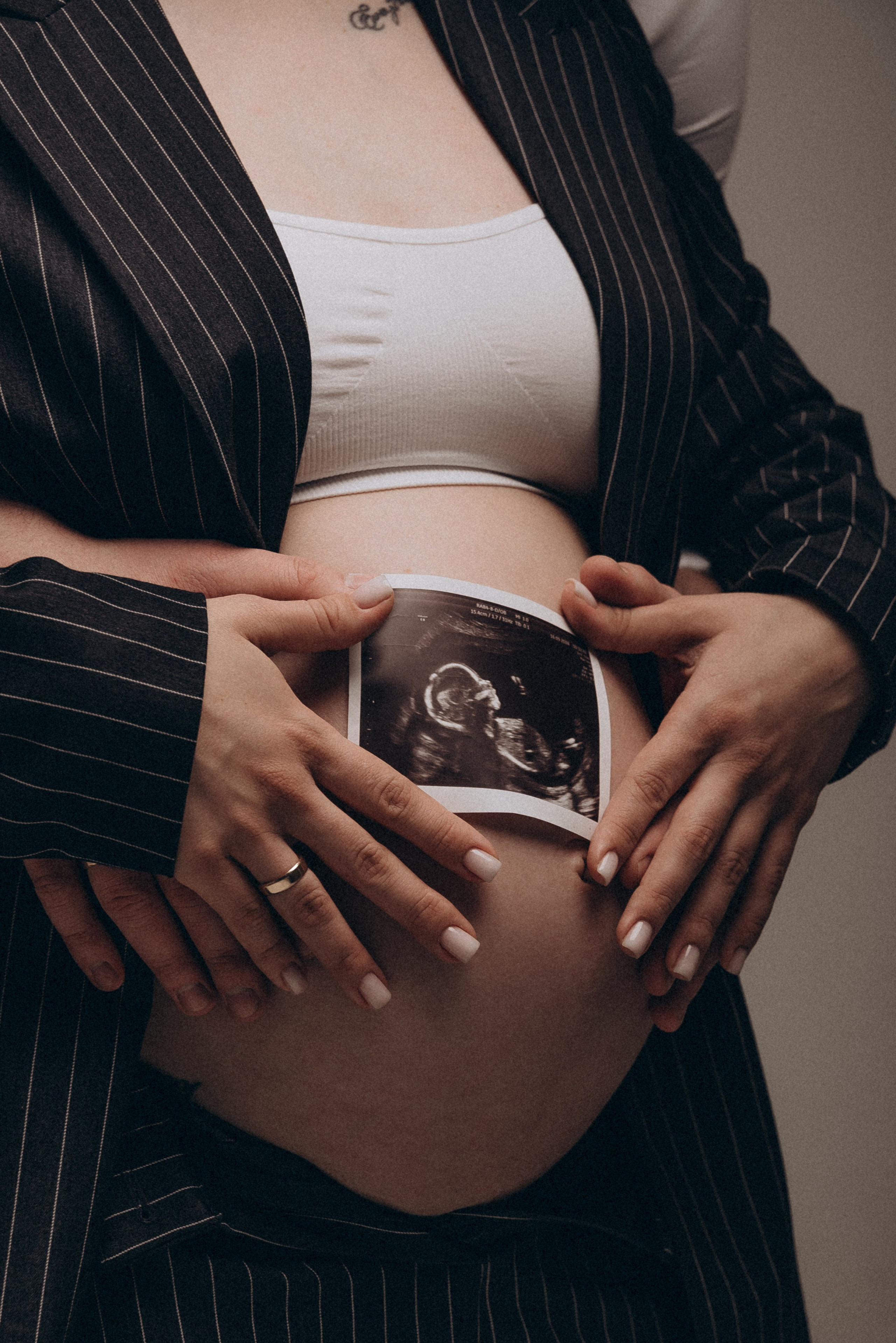 Waiting Baby's. ST.PHOTO13