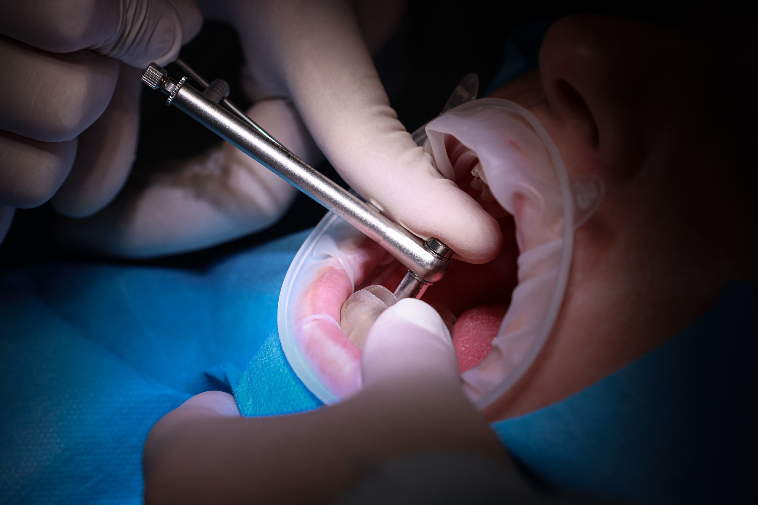 Colab Passionate Clinic. Fotograf & Videograf de Eveniment din Iași Ph.Vladimir