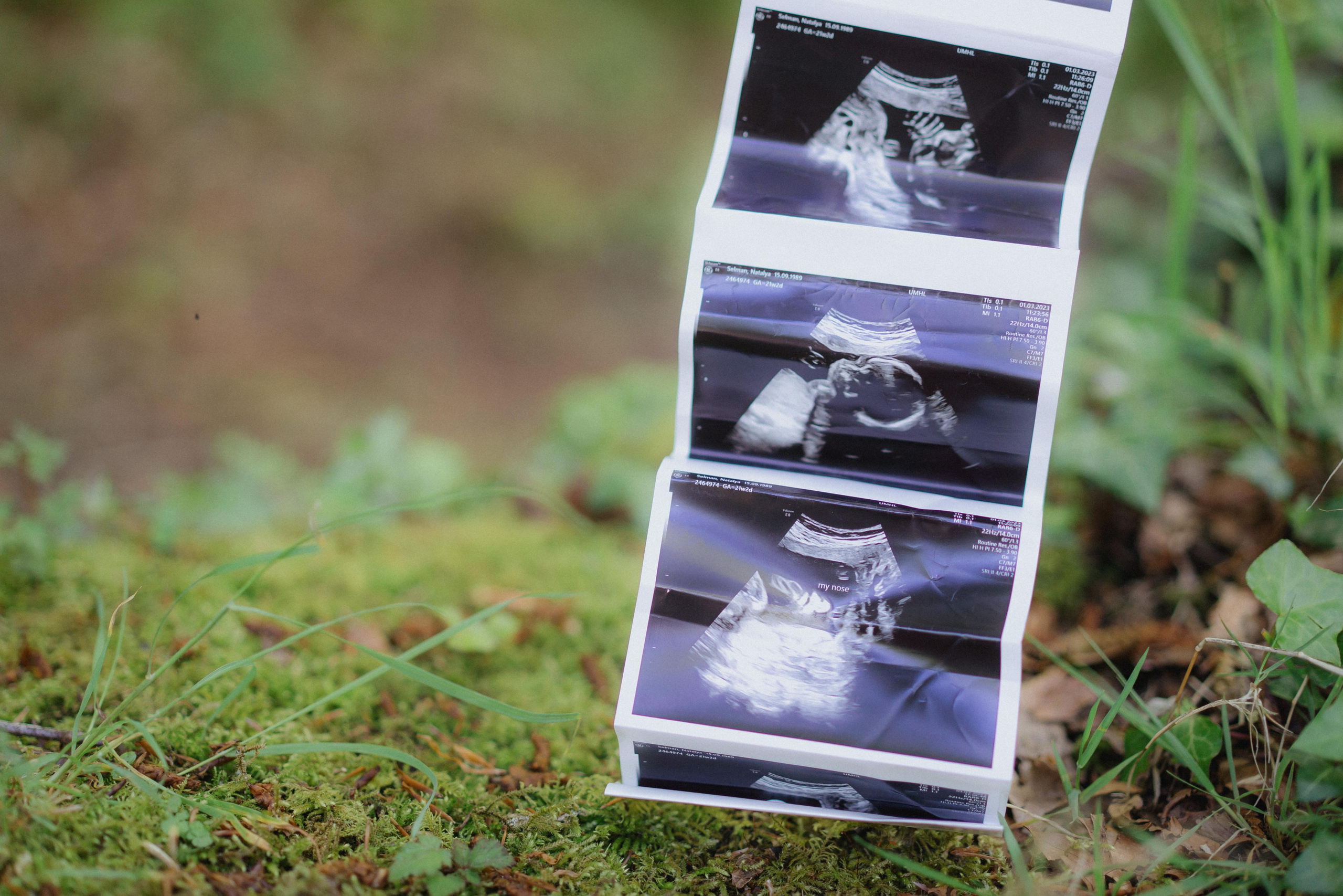 John and Natalia. Wedding and family photographer Ireland