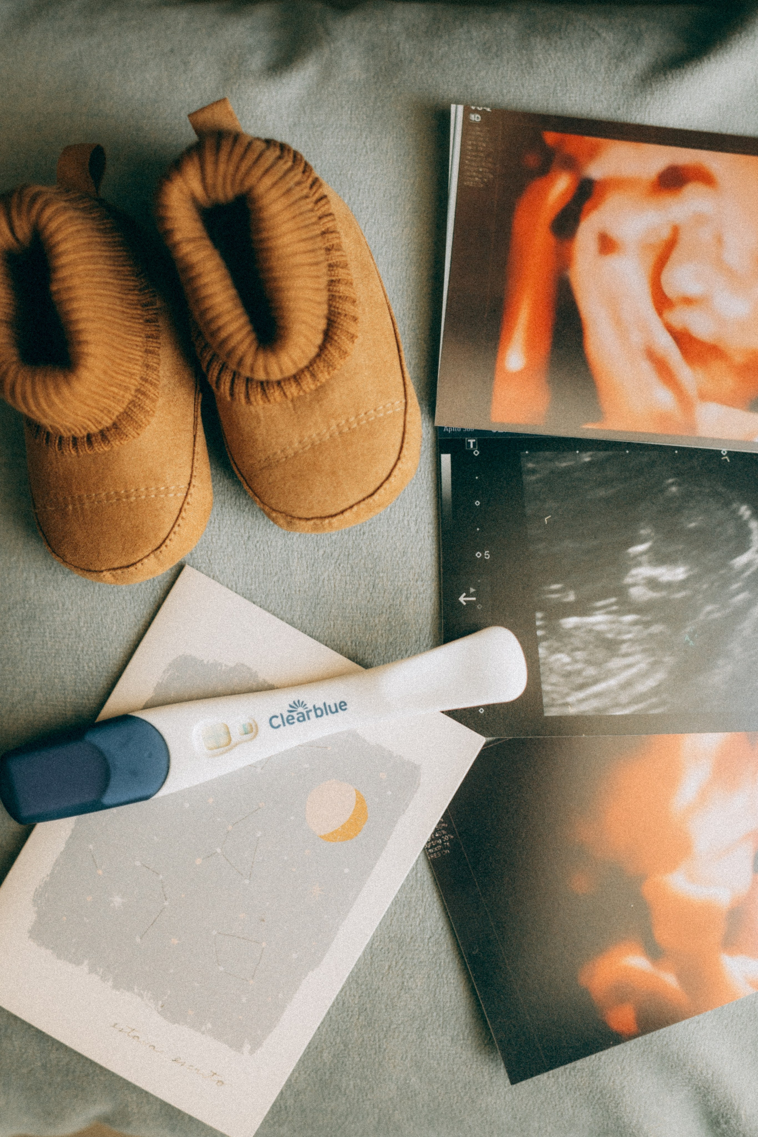 Adivinha o quanto eu te amo. Lídia Cabral Fotografia | Fotógrafa de casais e famílias em Gramado RS