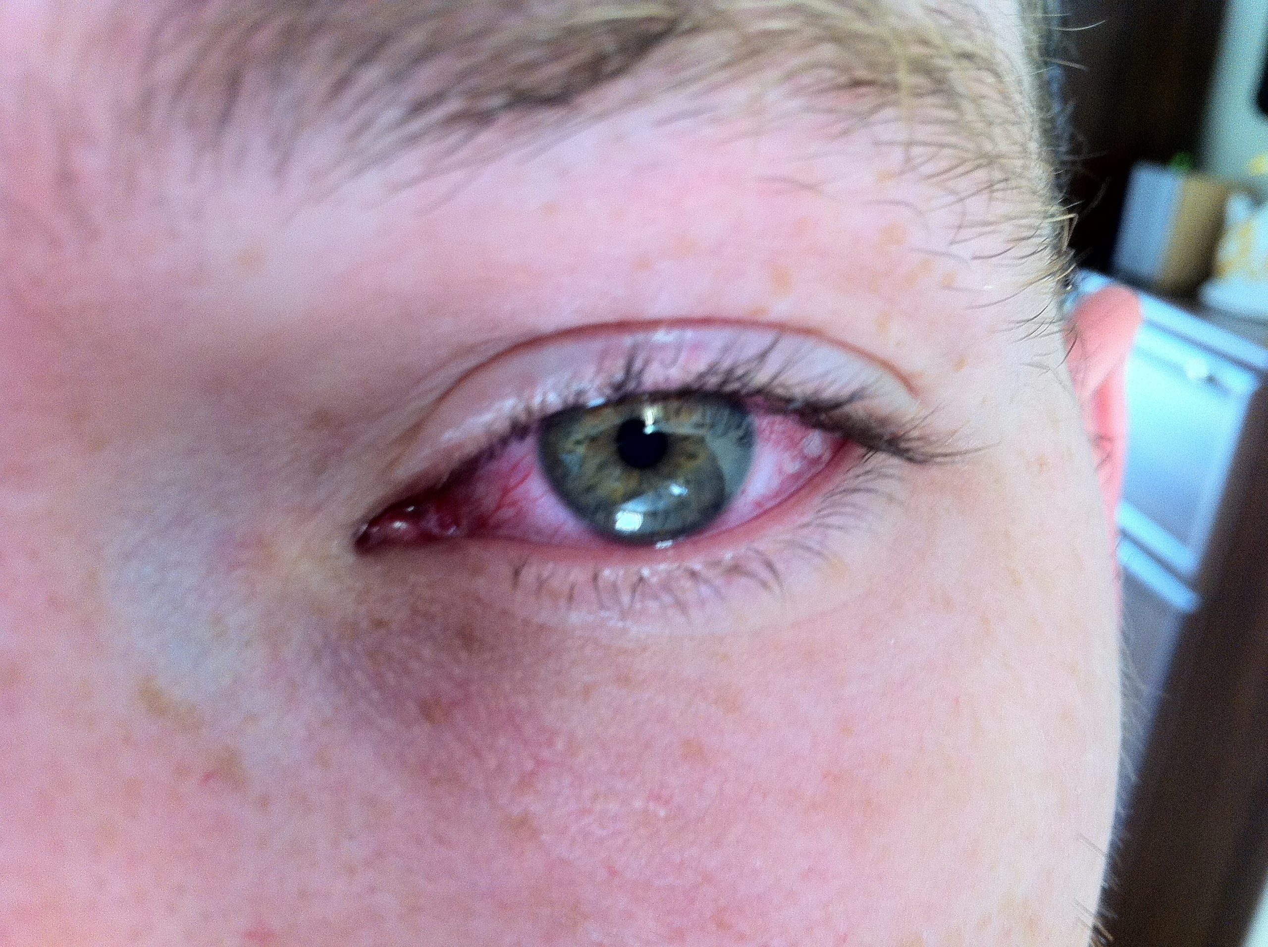 Everything from everything