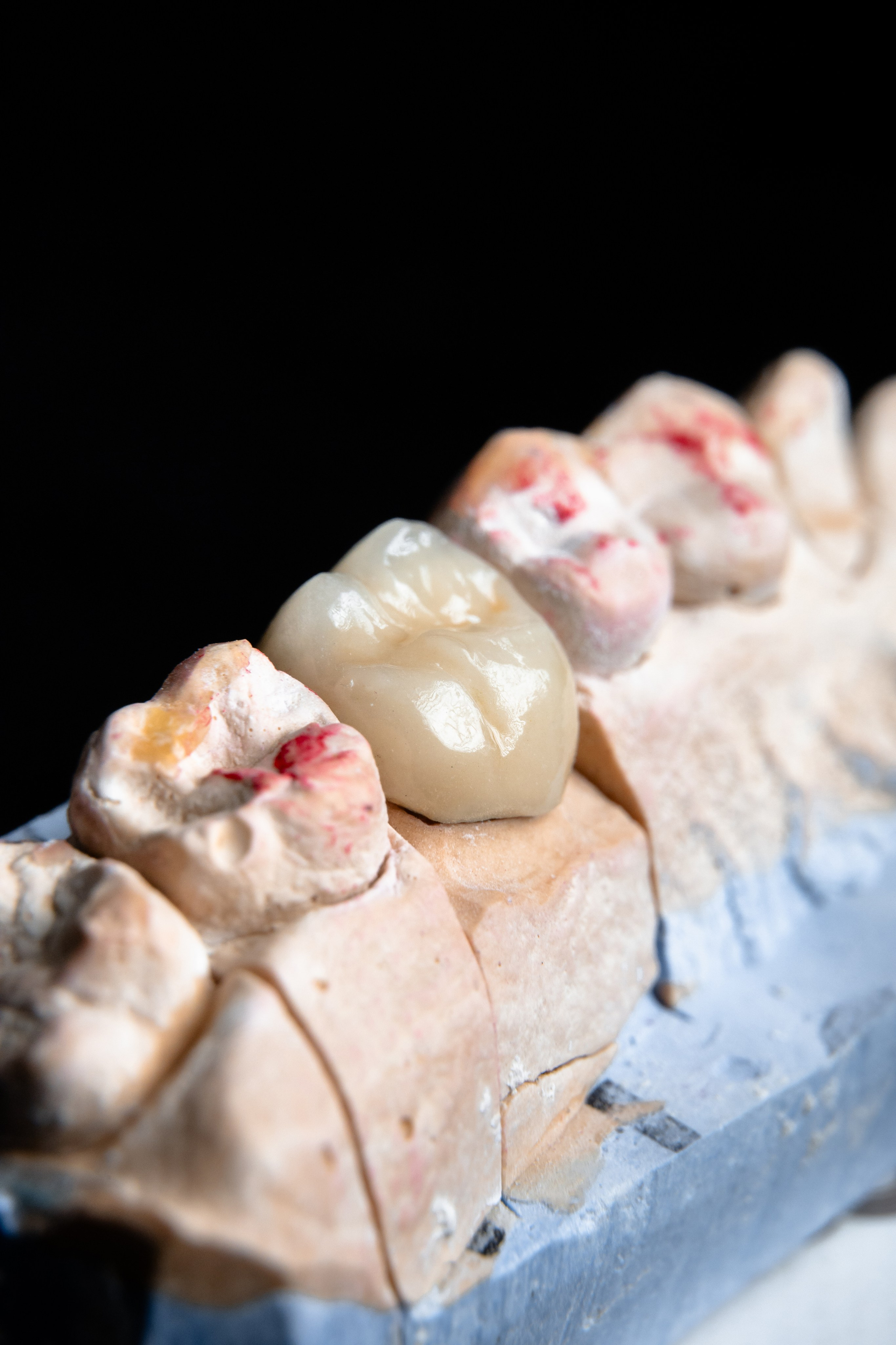 Smileline laboratory. 