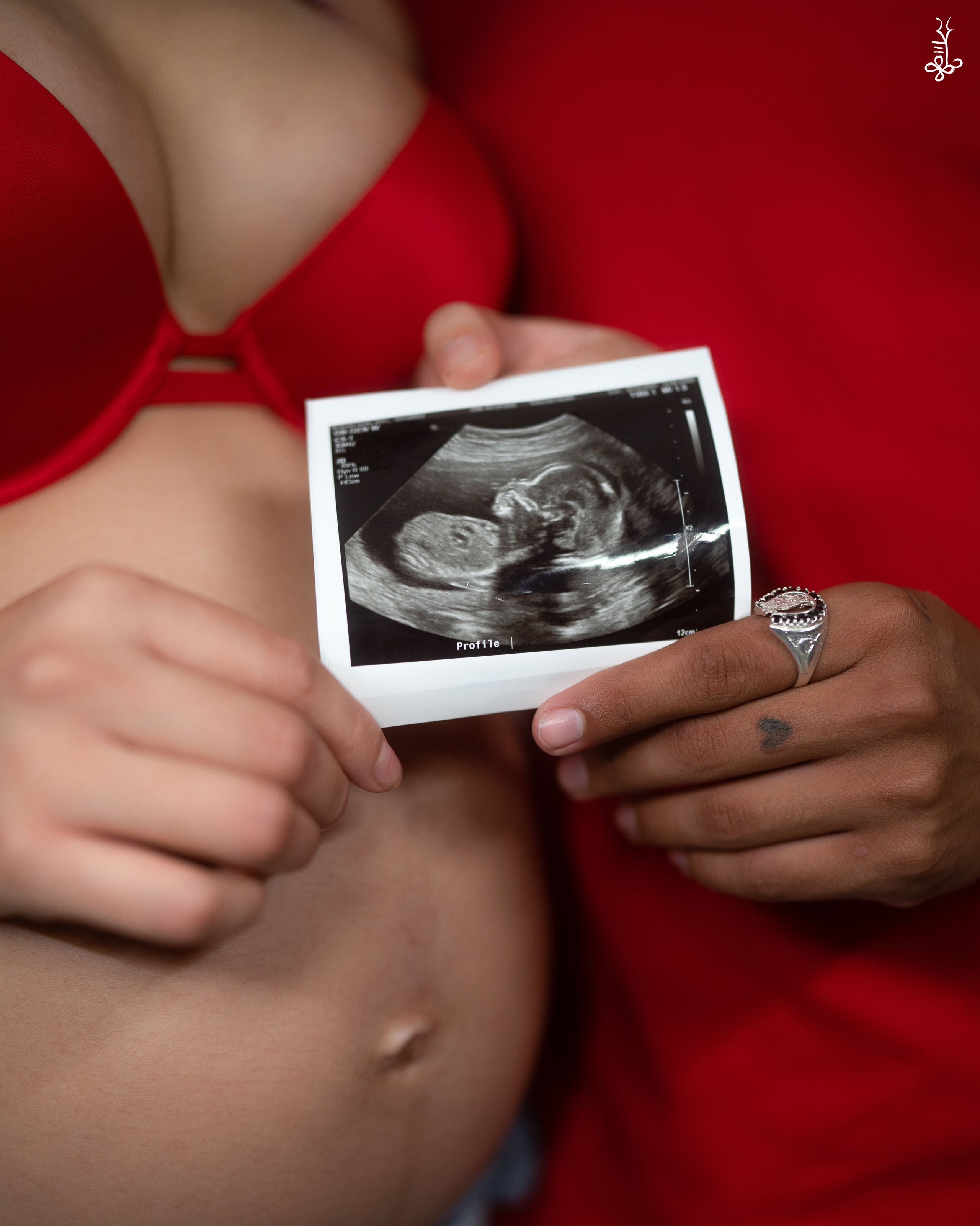 @AlV.NAHOMY & @CASPERSK8S. Ke’Ondris