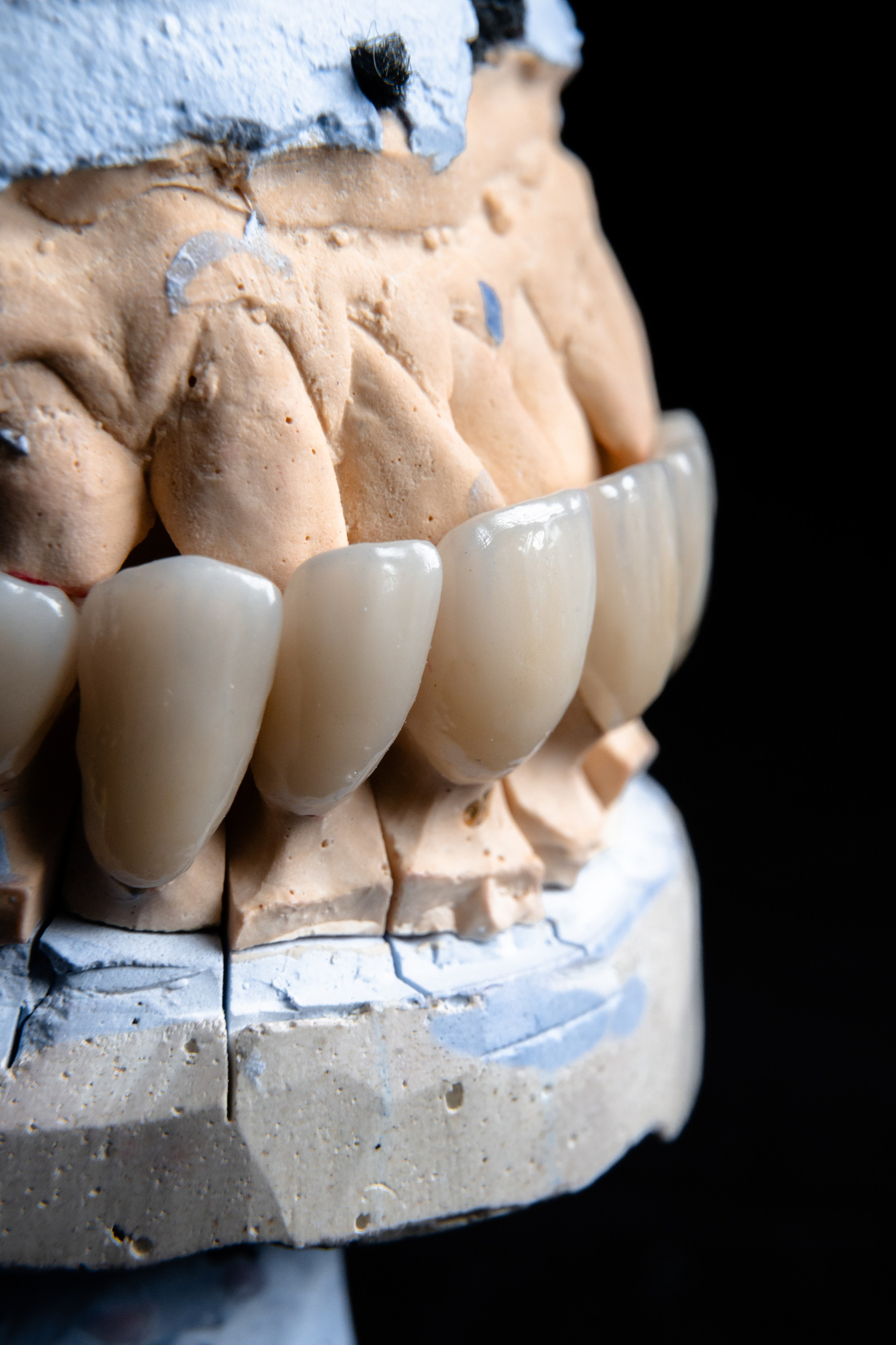 Smileline laboratory. 