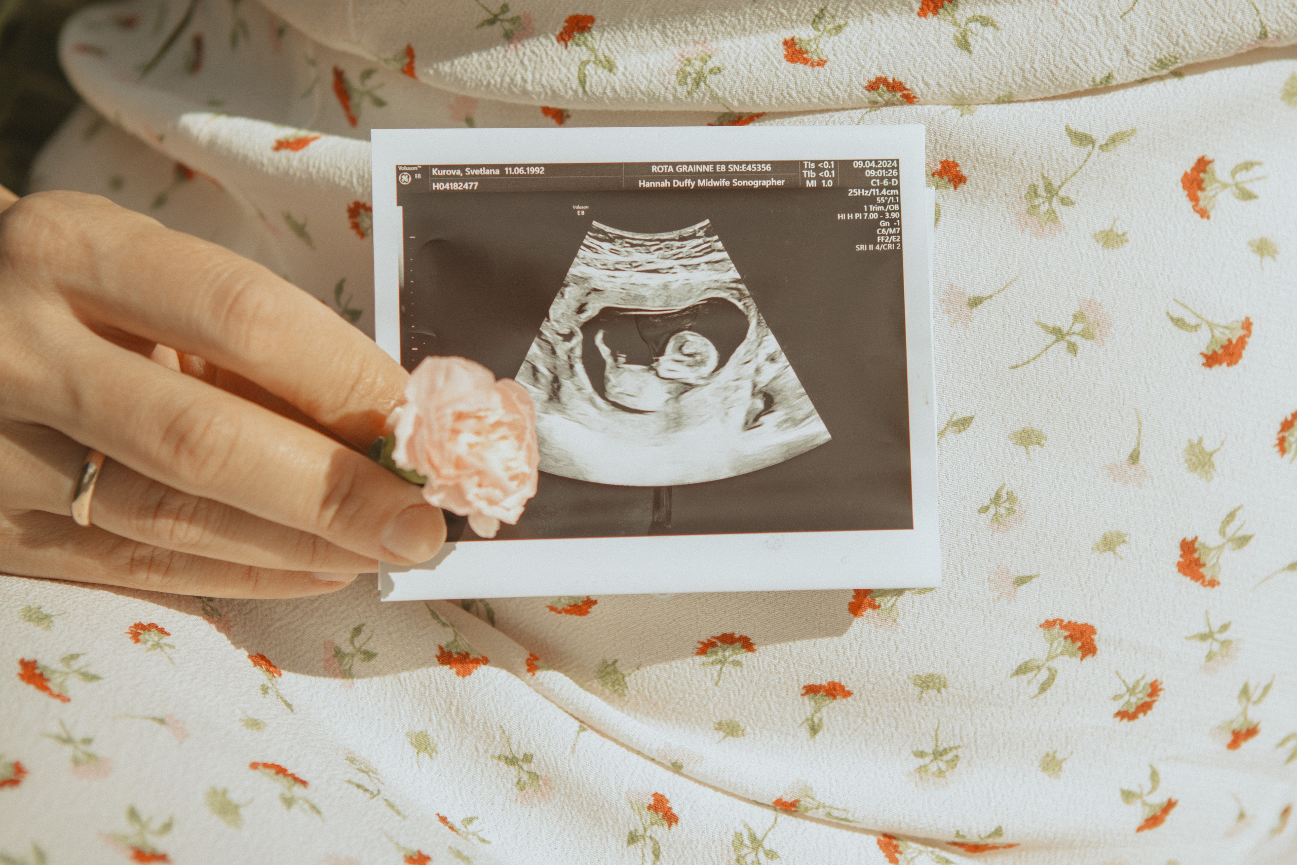 Expecting Pregnancy. Photographer Margarita Antonova in Naas, Co Kildare