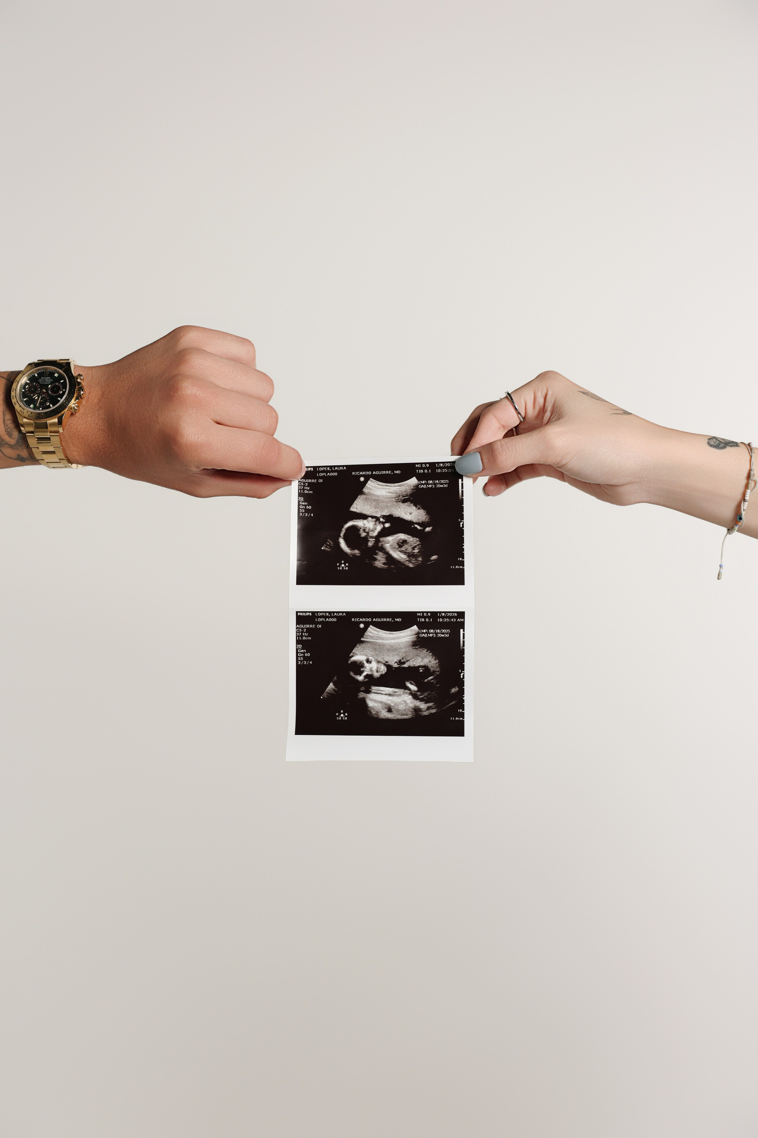 Fotografia de Gestante e Família | Moreti
