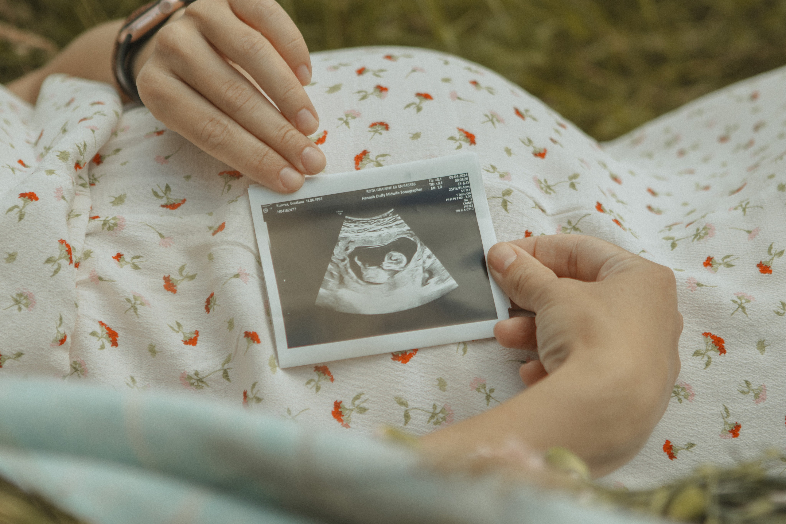 Expecting Pregnancy. Photographer Margarita Antonova in Naas, Co Kildare