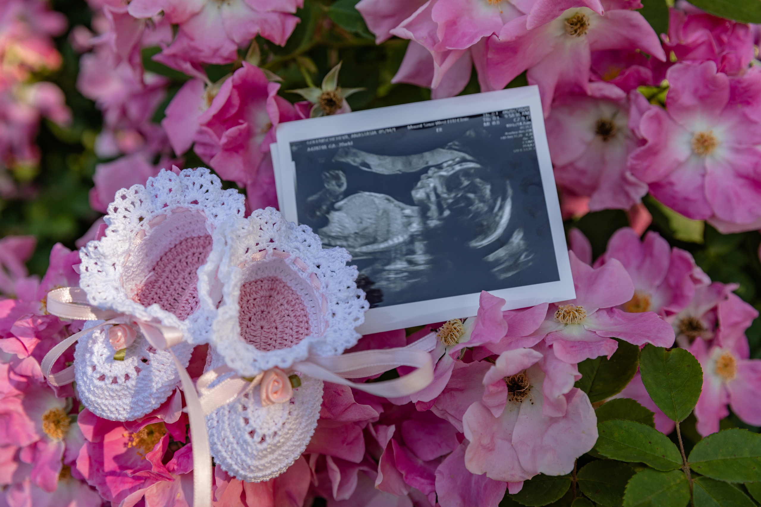 ANASTASIA & RAUL MATERNITY. Pittsburgh wedding and family photographer