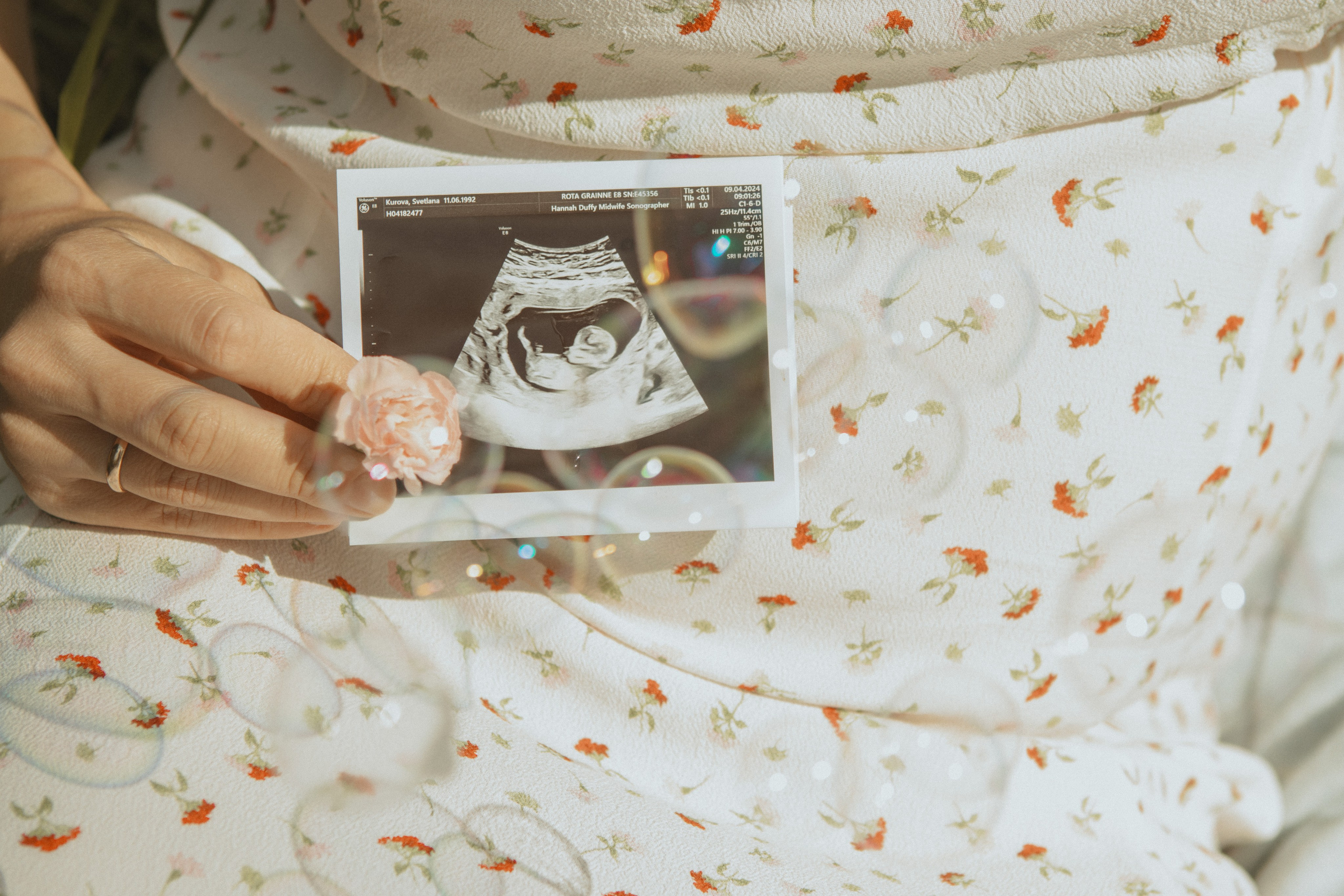 Expecting Pregnancy. Photographer Margarita Antonova in Naas, Co Kildare