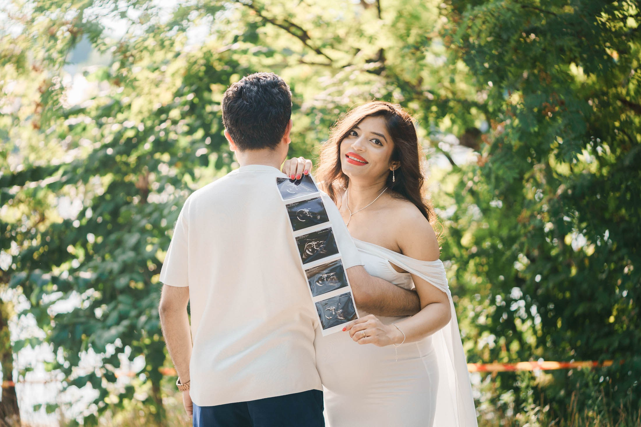 Mustavalkoinen ultraäänikuva odotusajan kuvauksessa