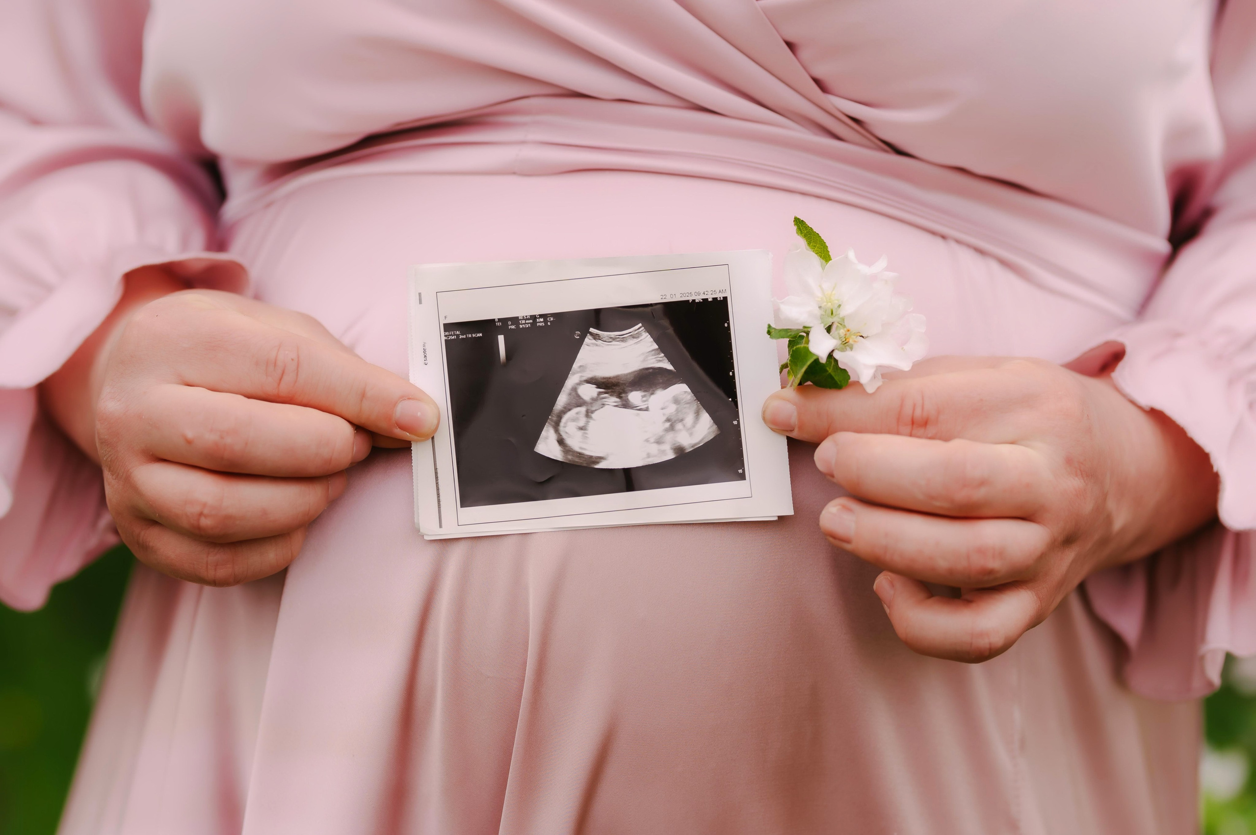 Kamilės nėščioji fotosesija. Rokas Baranauskas fotografija
