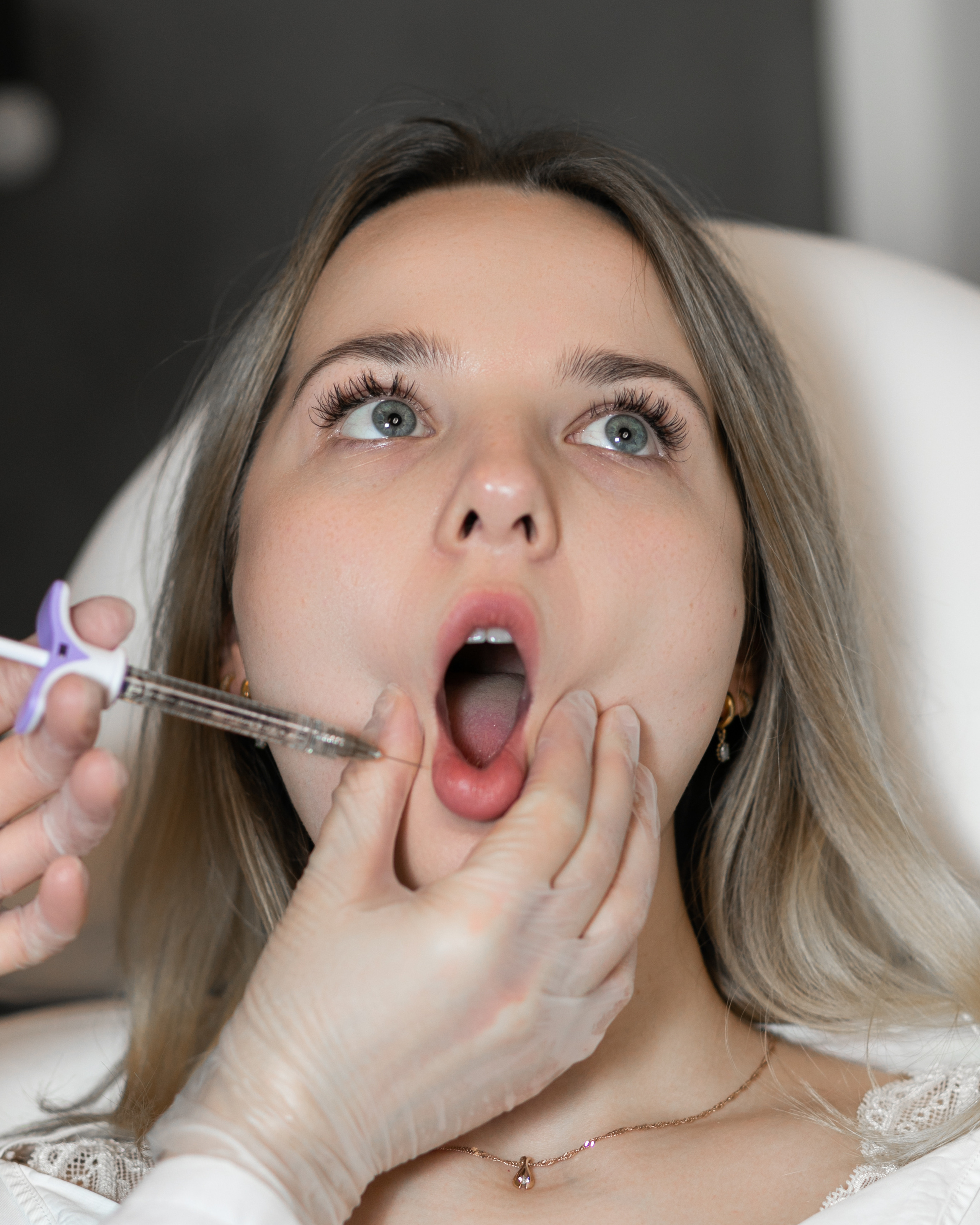 Botox and fillers. Professional wedding photographer in Copenhagen, Denmark — Julia Byron