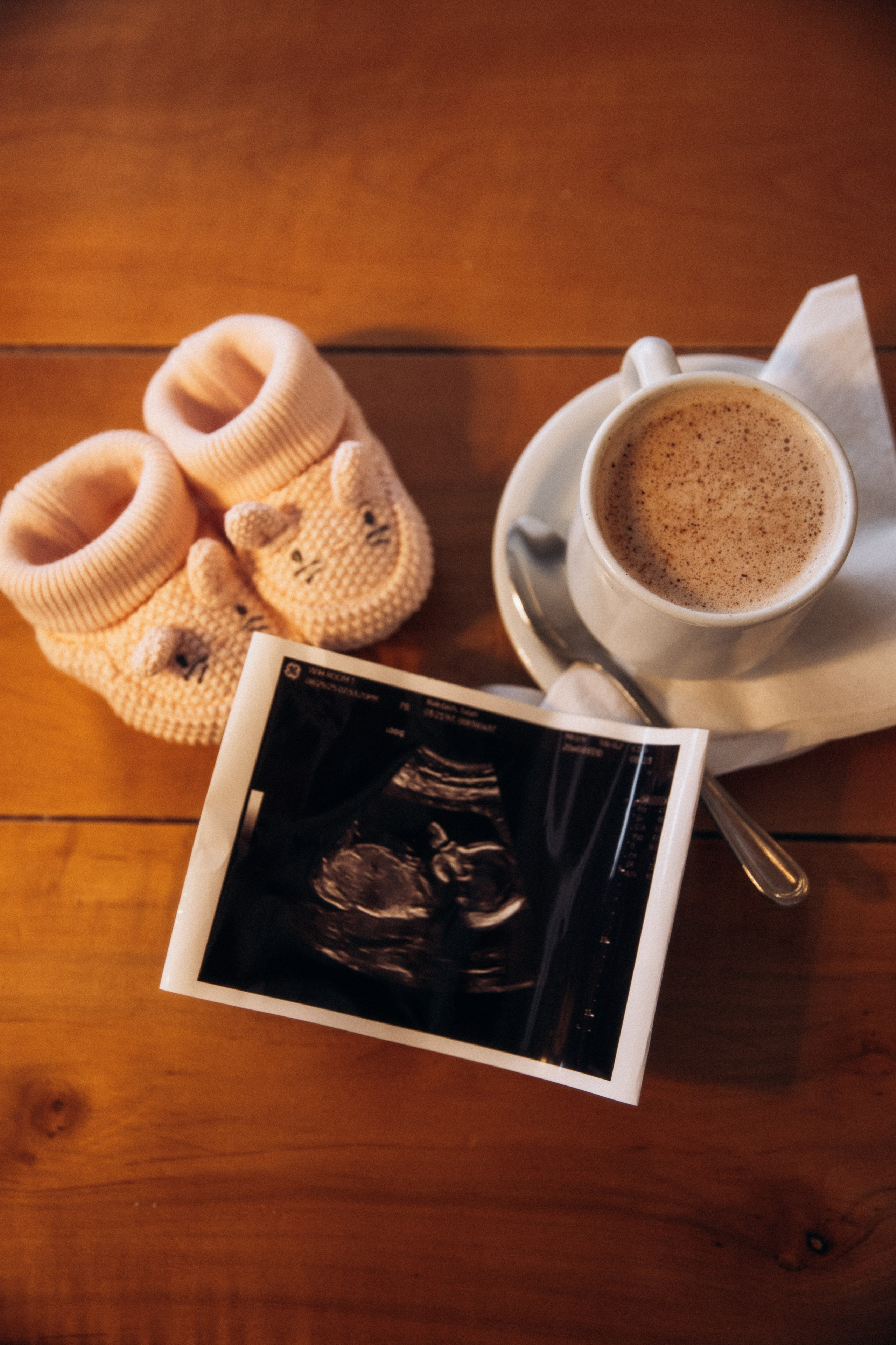 Winter Pregnancy Photoshoot | Bacon Hill, Boston