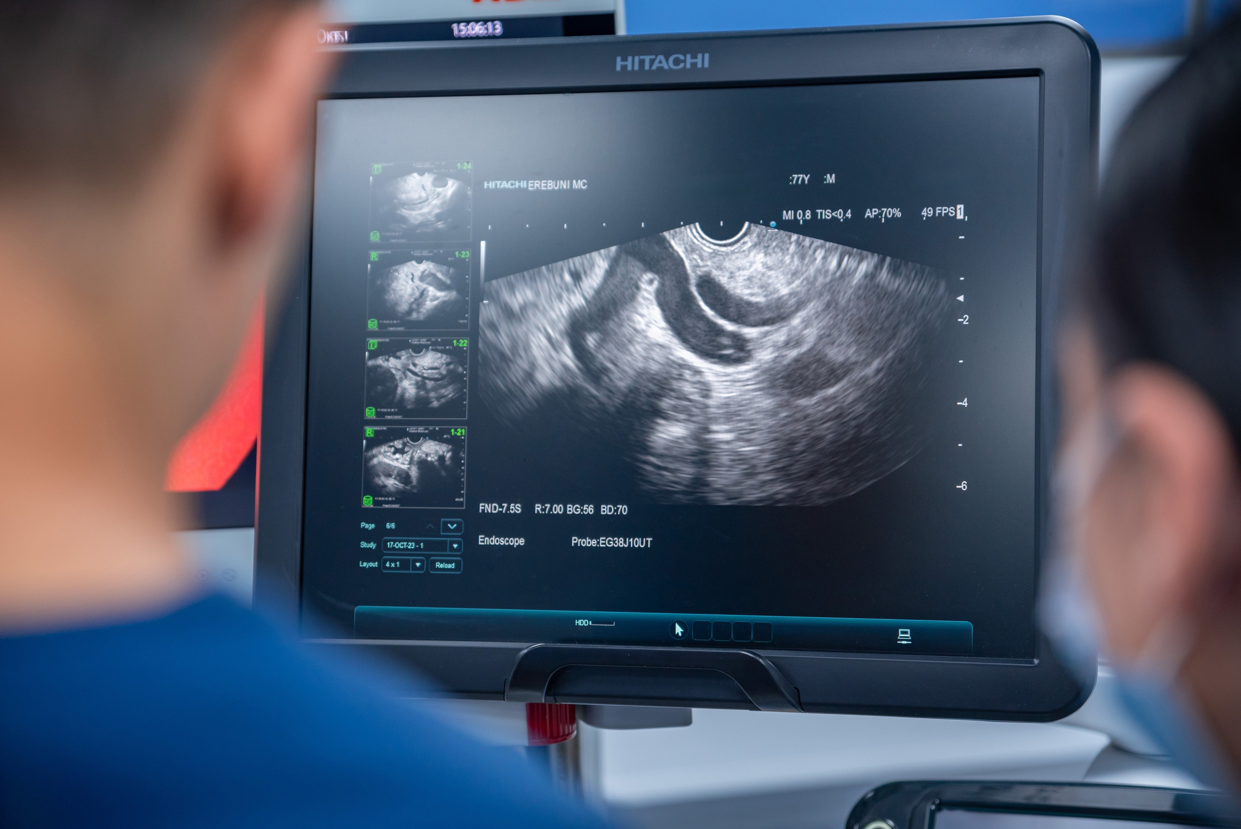 Medical. Photographer in Yerevan