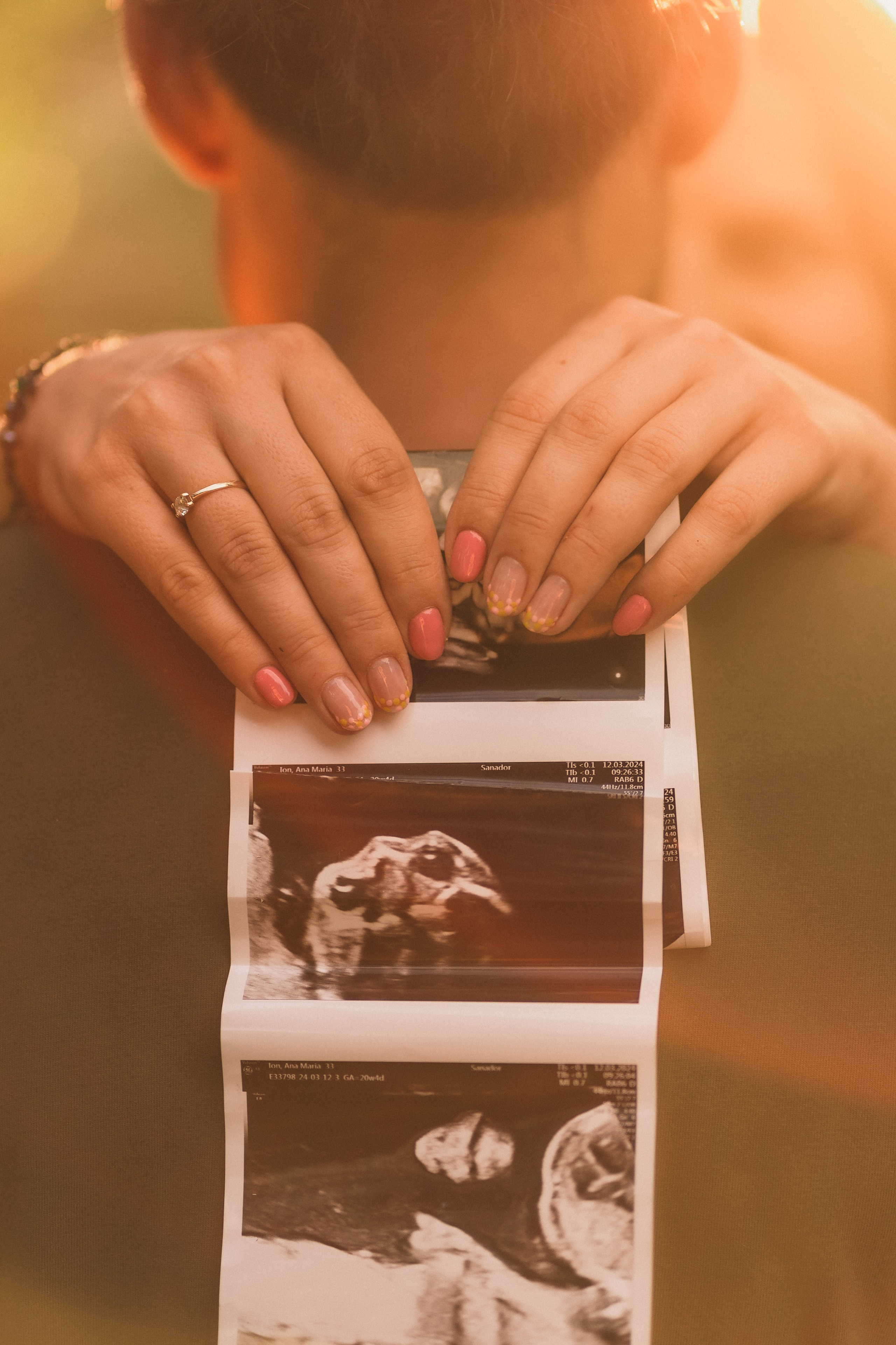 Ana & Florin. Dara Lens | The art of remembering