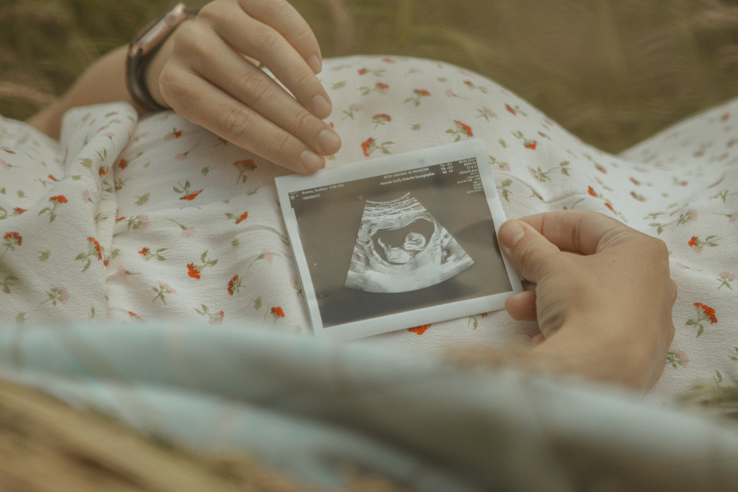 Expecting Pregnancy. Photographer Margarita Antonova in Naas, Co Kildare