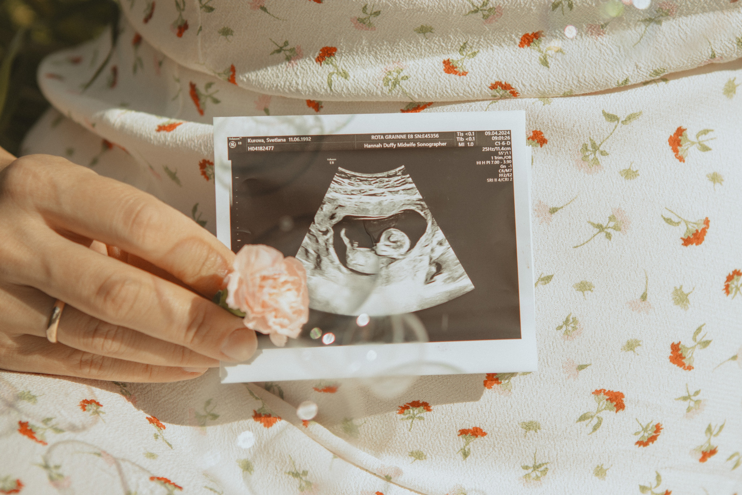 Expecting Pregnancy. Photographer Margarita Antonova in Naas, Co Kildare