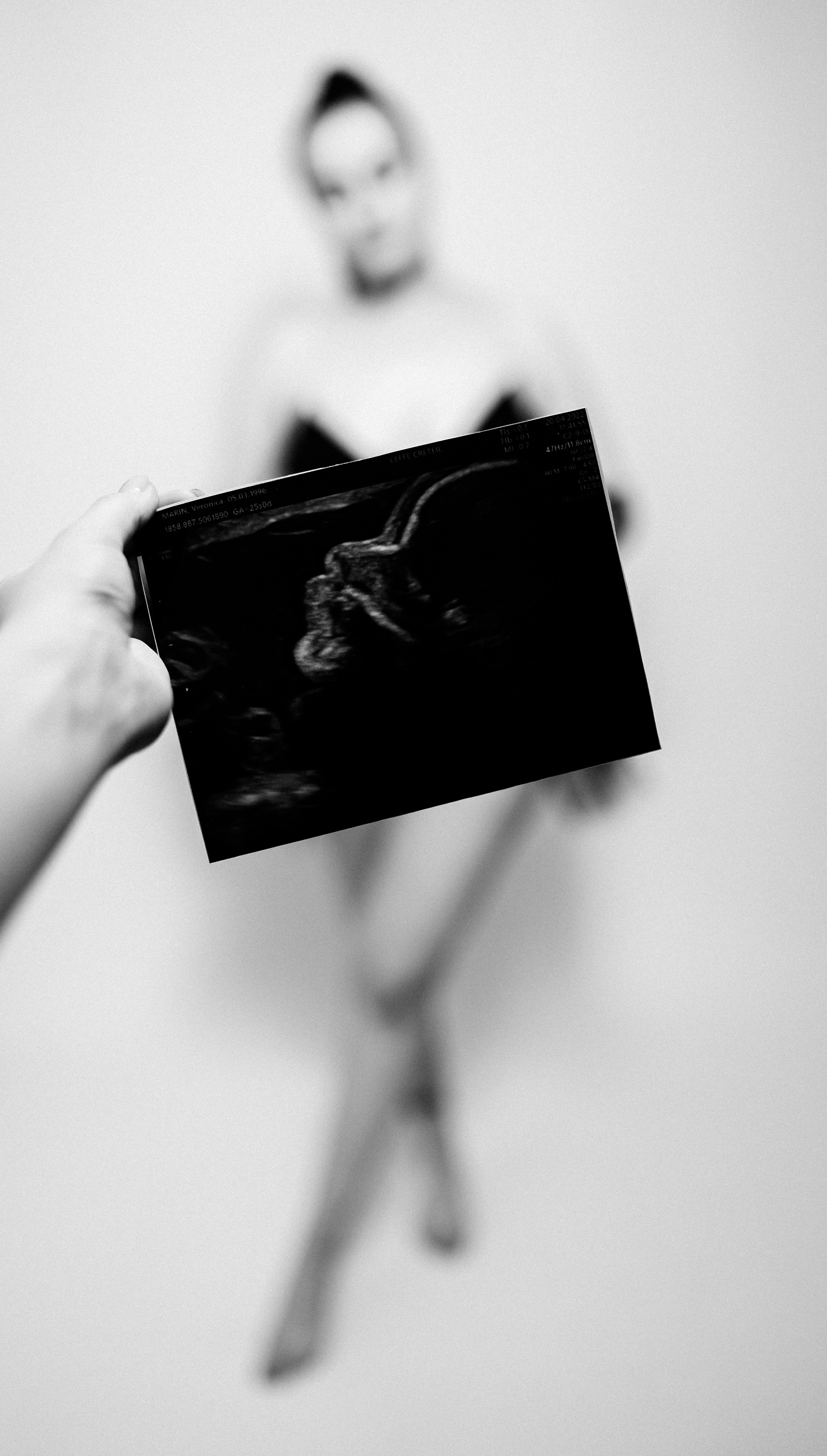 Pregnancy1. Https://www.instagram.com/grosu.photography?igsh=MTR6Y2xobGw1ZTluZg%3D%3D&utm_source=qr