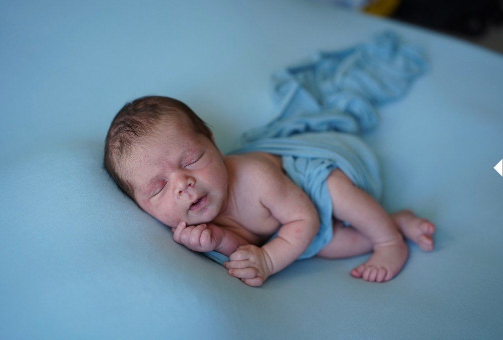 Should You Postpone Your Newborn Photo Session If Your Baby Has Acne? (Answered by a Pro Photographer). Maternity, family and newborn photography in San Francisco Bay Area
