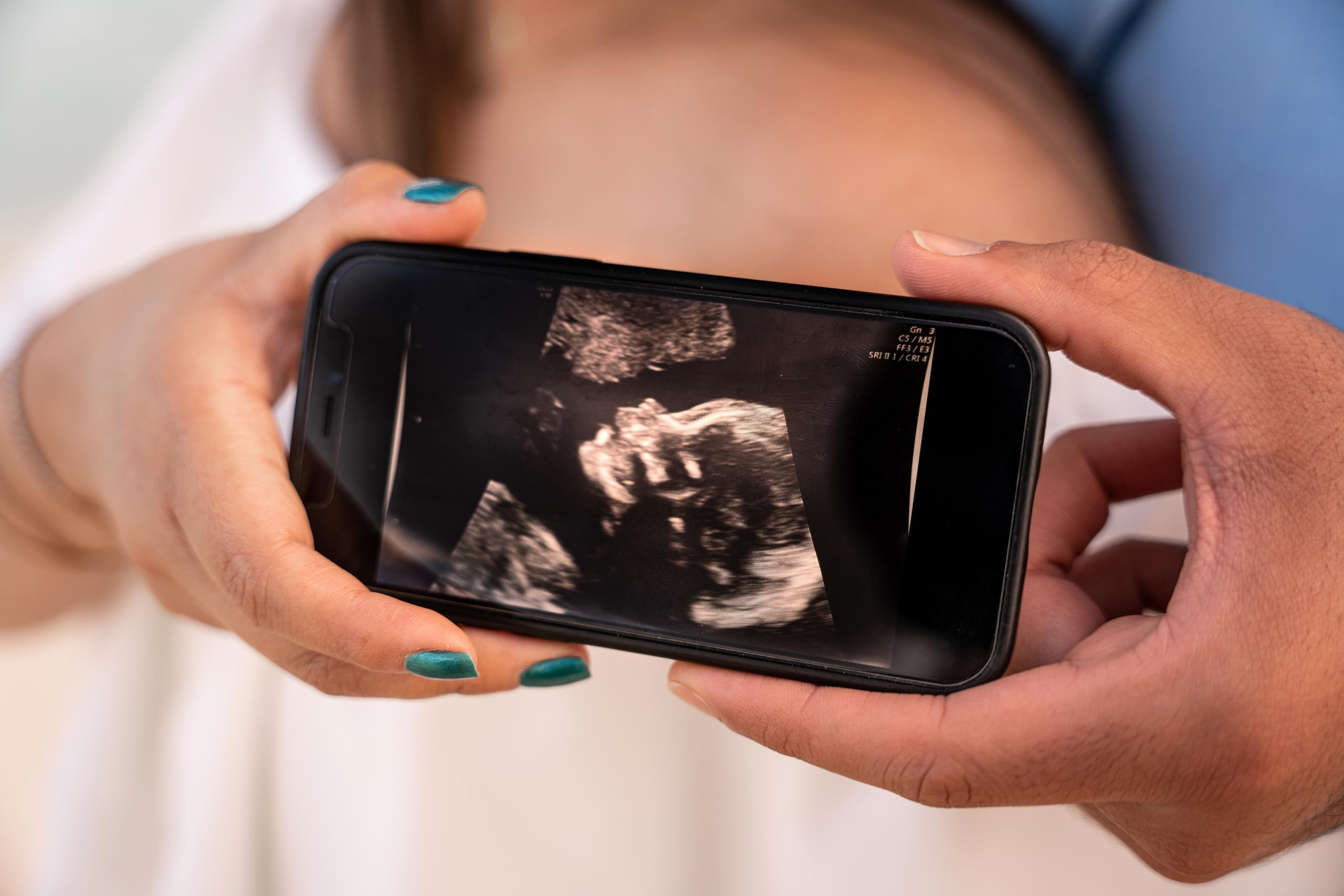 Maternity. Victoria Liskova. Photographer in Mexico