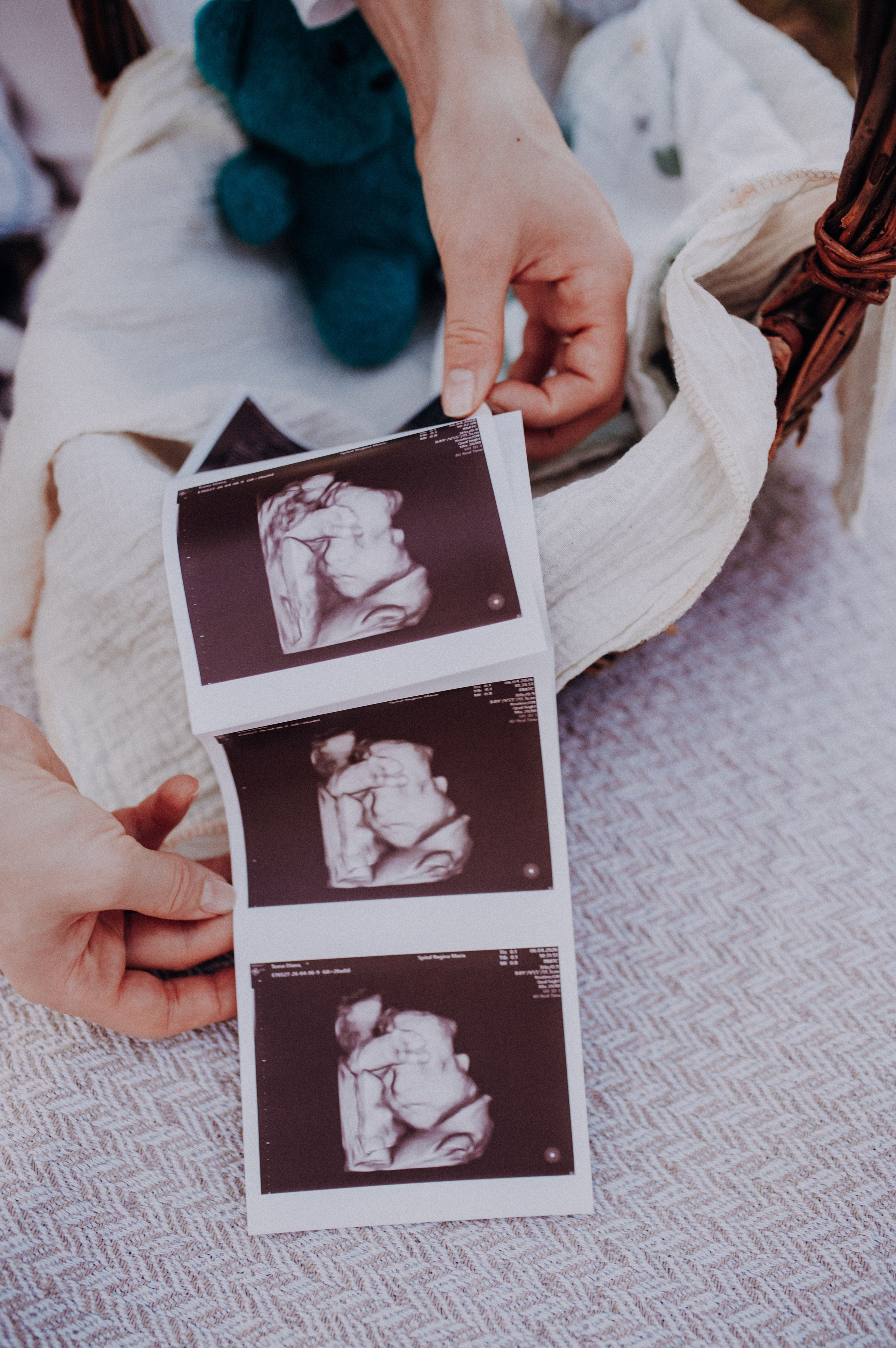 Ședință Foto Maternitate Cluj-Napoca | Diana & Dan