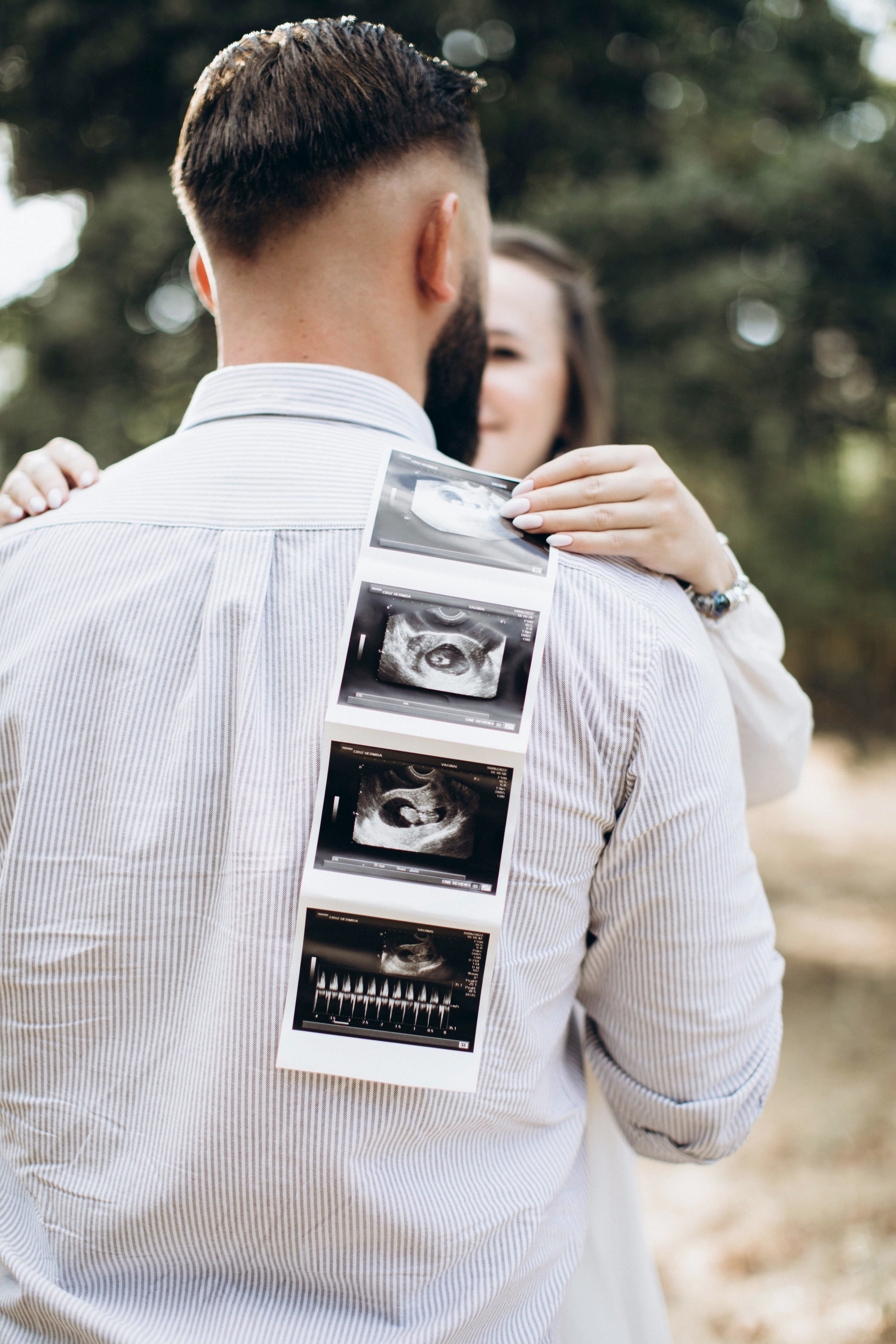 Gender reveal: Міша і Оксана. Twolovingsouls™: жіночий портрет і сімейна фотографія Київ | Ірпінь