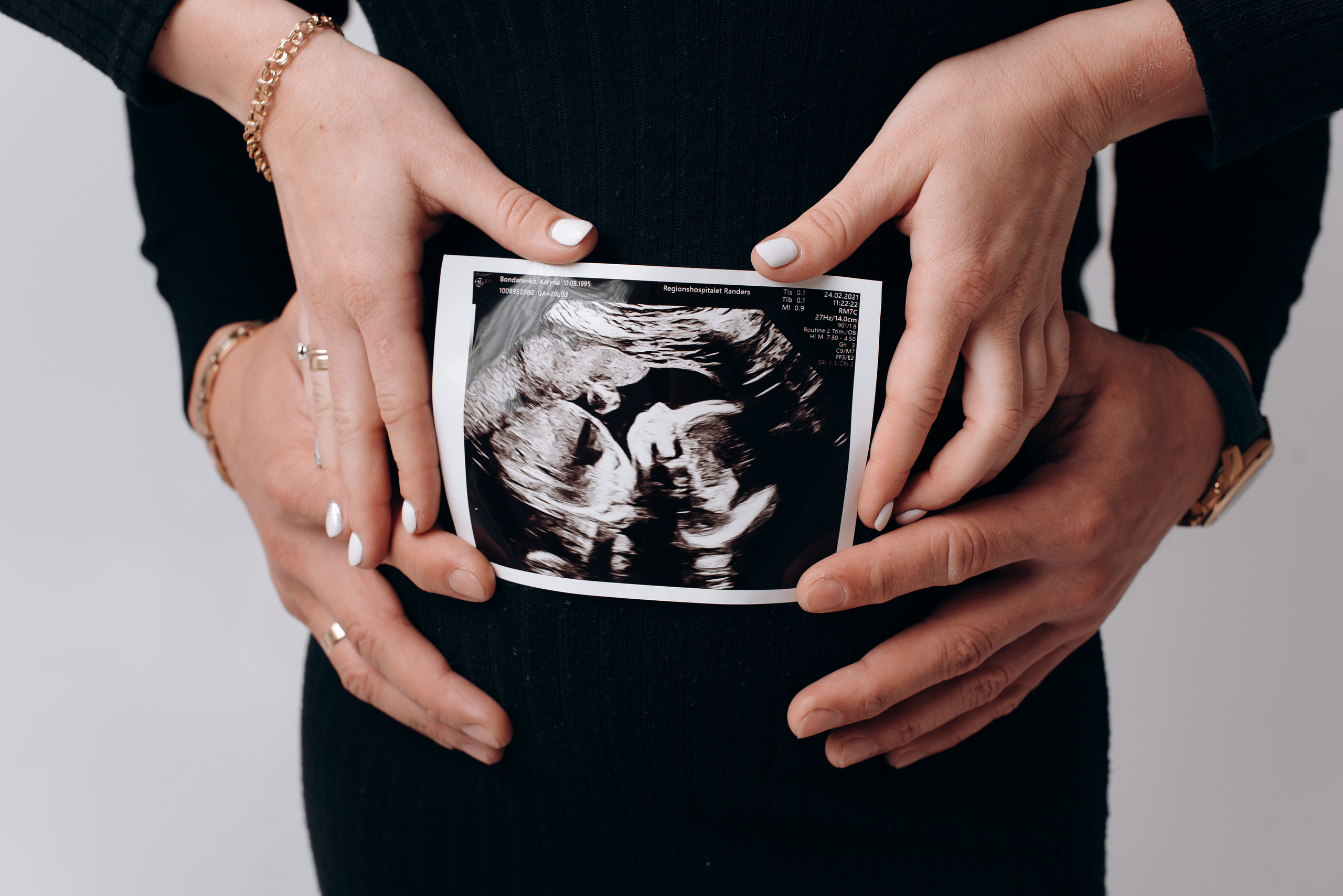 Свадебный фотограф Черкассы Киев. Весільний фотограф Черкаси Україна Вадим Биць