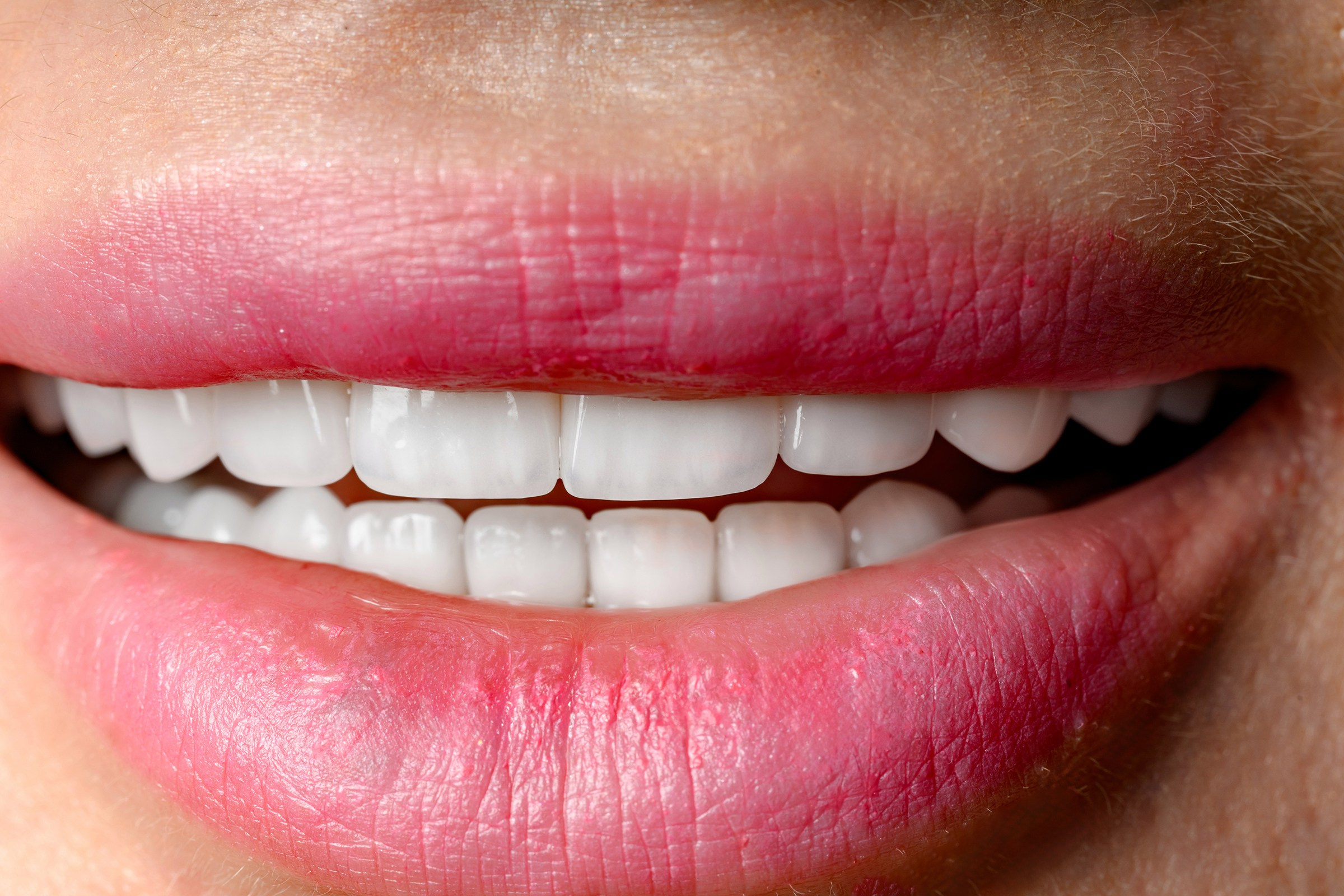 «DENTA MIA». Свадебный и семейный фотограф