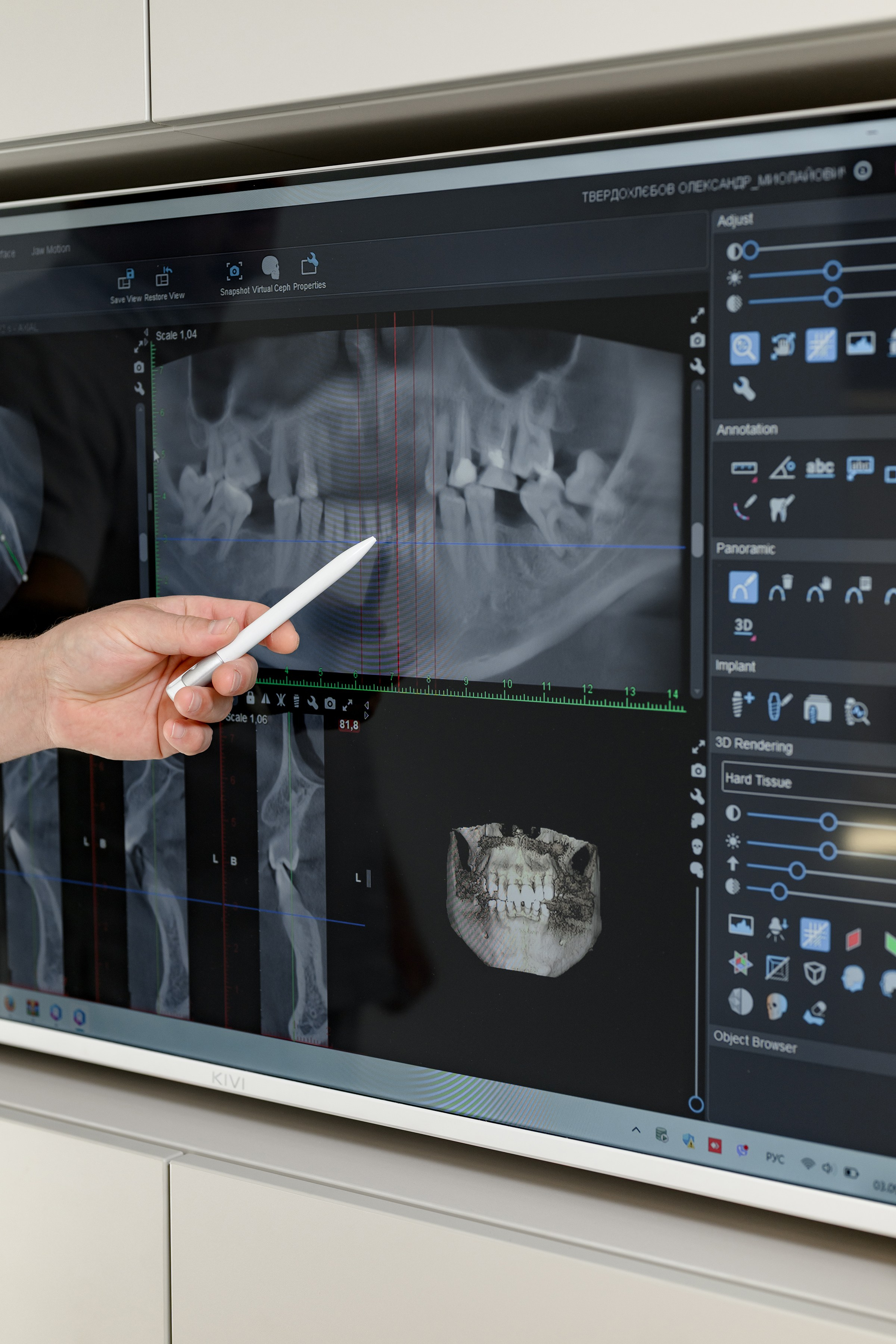 «DENTA MIA». Свадебный и семейный фотограф