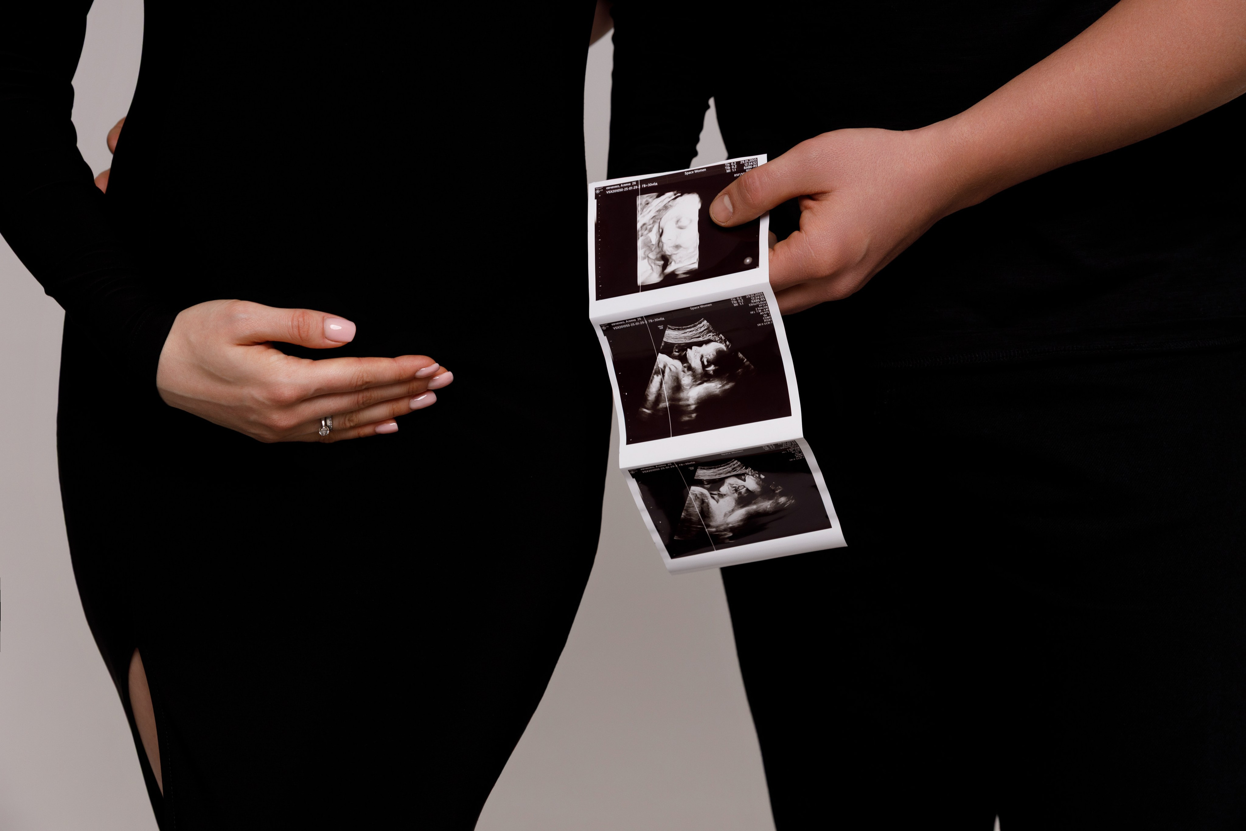 Аліна & Роман. Весільний та сімейний фотограф у Харкові Ткаченко Світлана