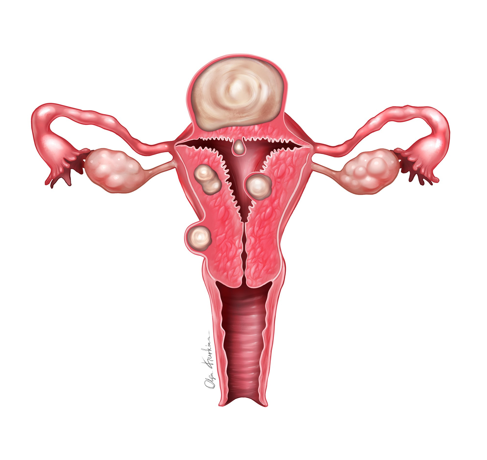 Professional freelance medical illustrator