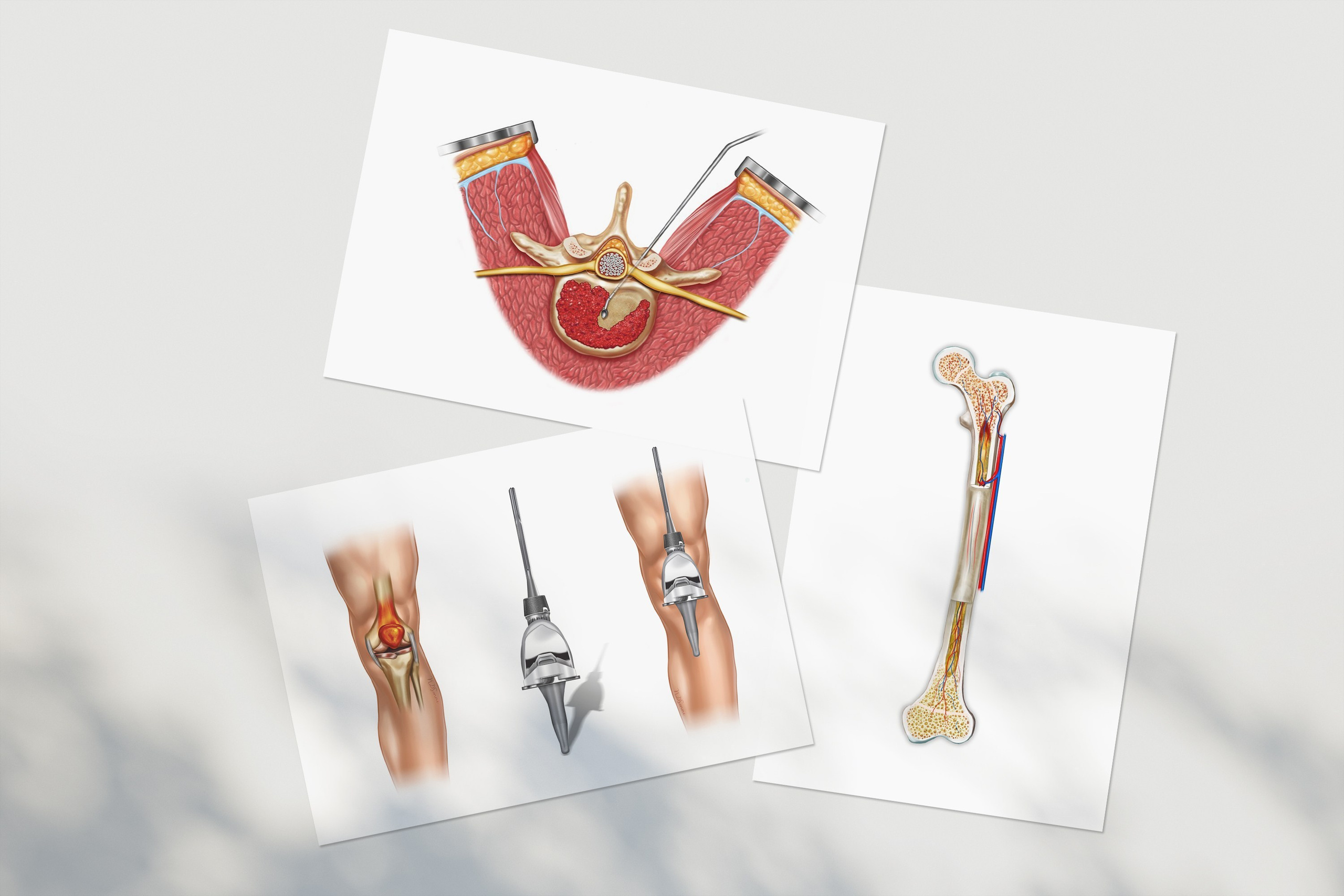 Professional freelance medical illustrator