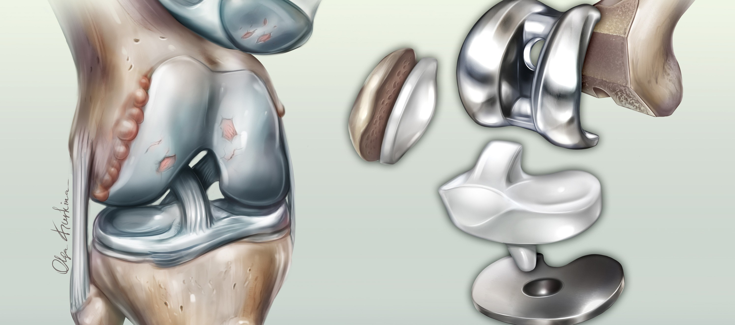 Professional freelance medical illustrator