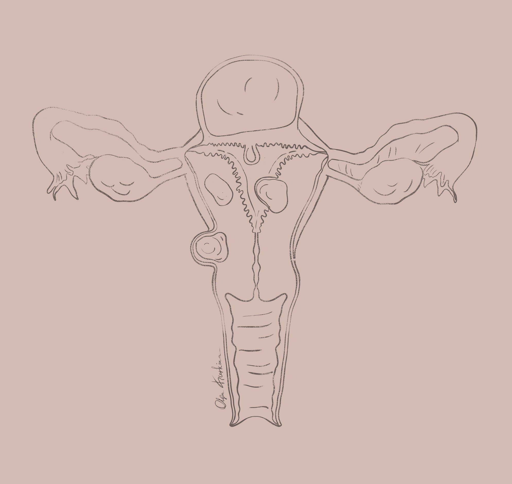 Professional freelance medical illustrator