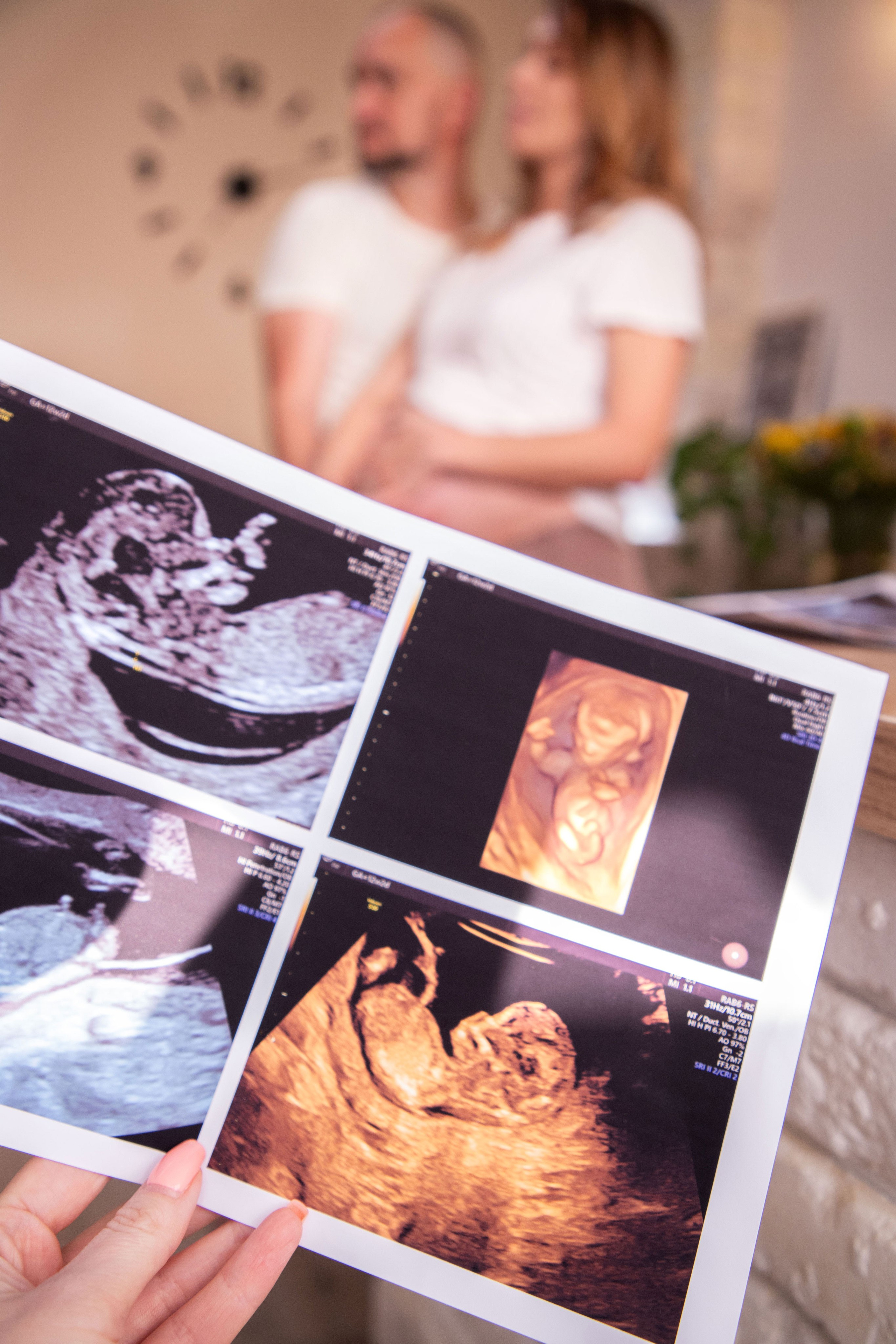 Фотосесія вагітності в колі сім’ї. Сімейний та дитячий фотограф Київ, Ірпінь, Буча — Галина Пивоварова