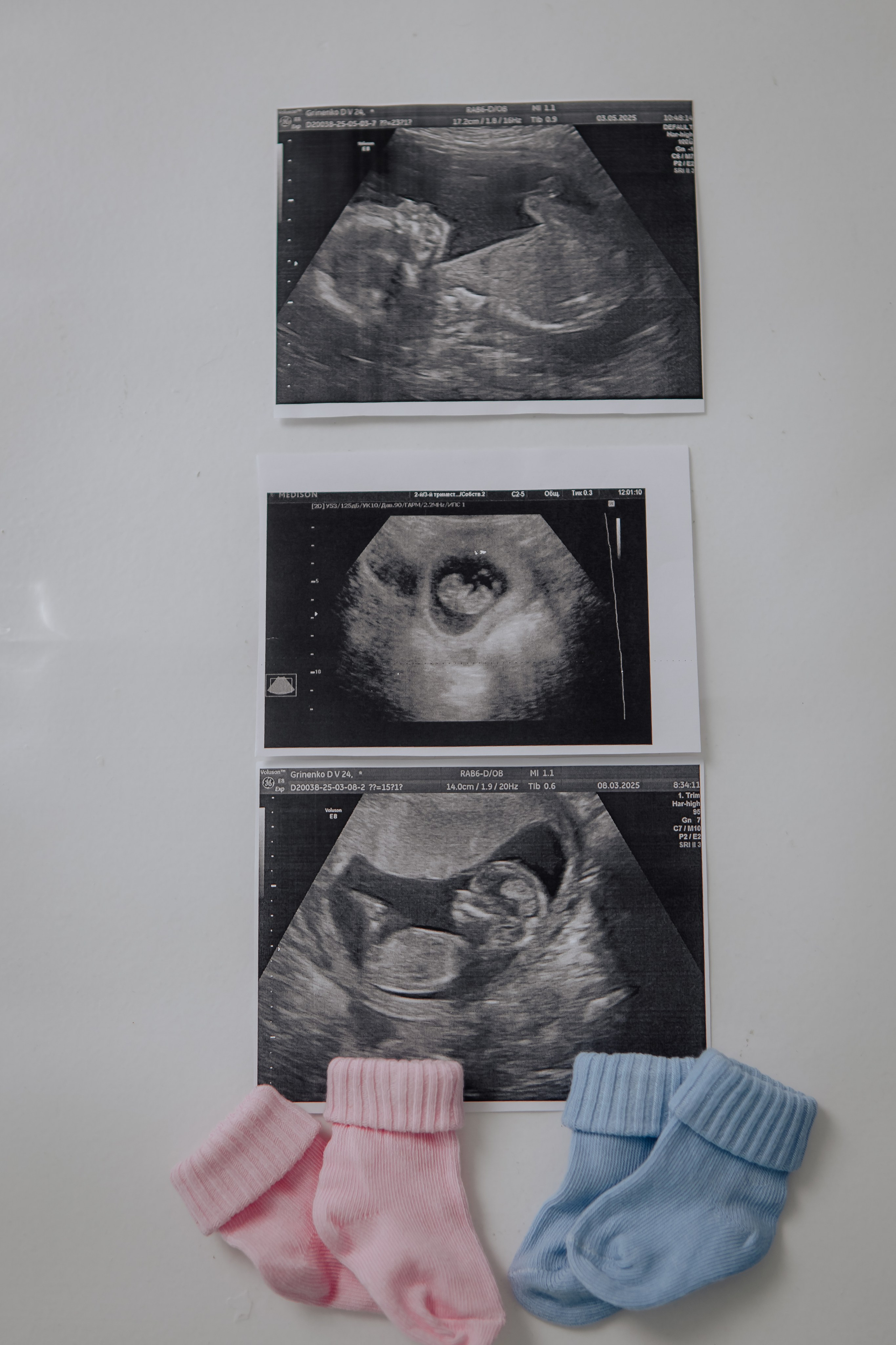 Фотосесія Вагітності. Фотограф — видеограф г. Днепр Марина Еременко